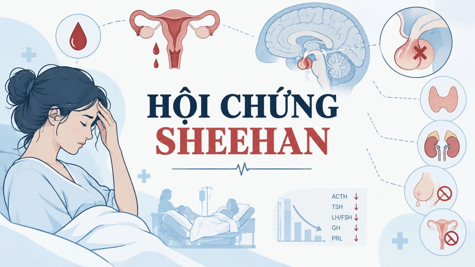 benh_a_z_hoi_chung_sheehan_1_1f3bf6a695