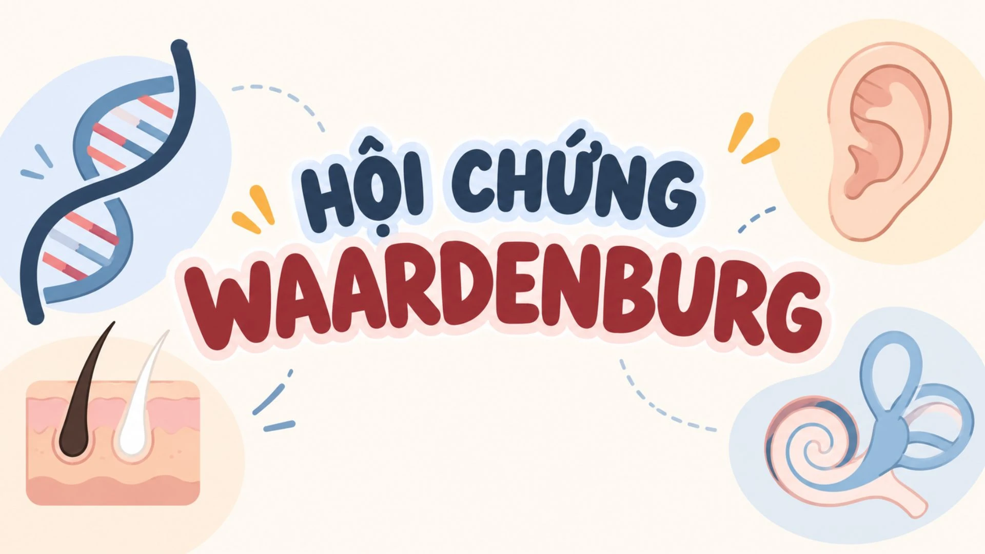 benh_a_z_hoi_chung_waardenburg_1_ba958afa7f