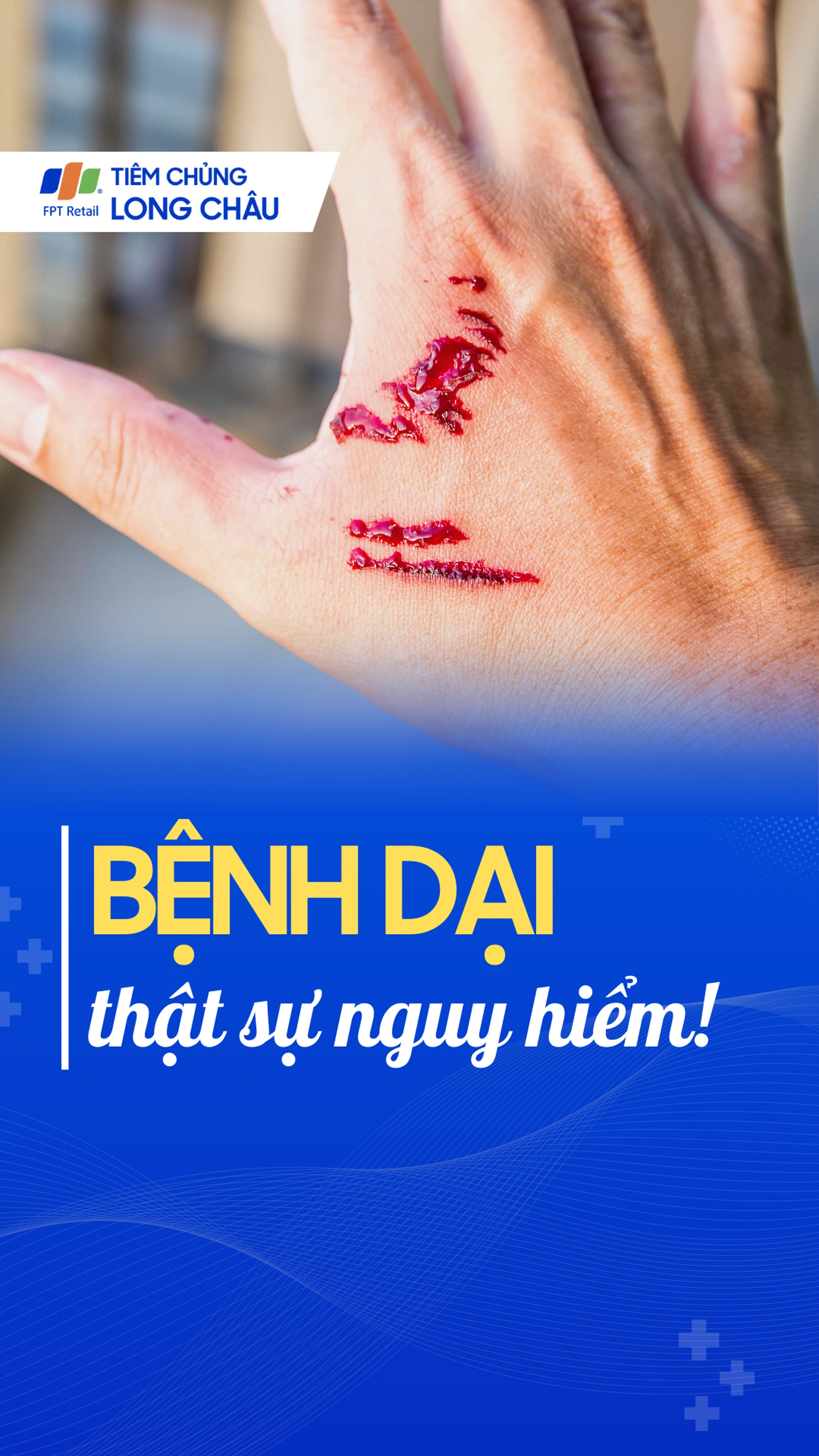 benh_dai_thuc_su_nguy_hiem_0aed3668bd