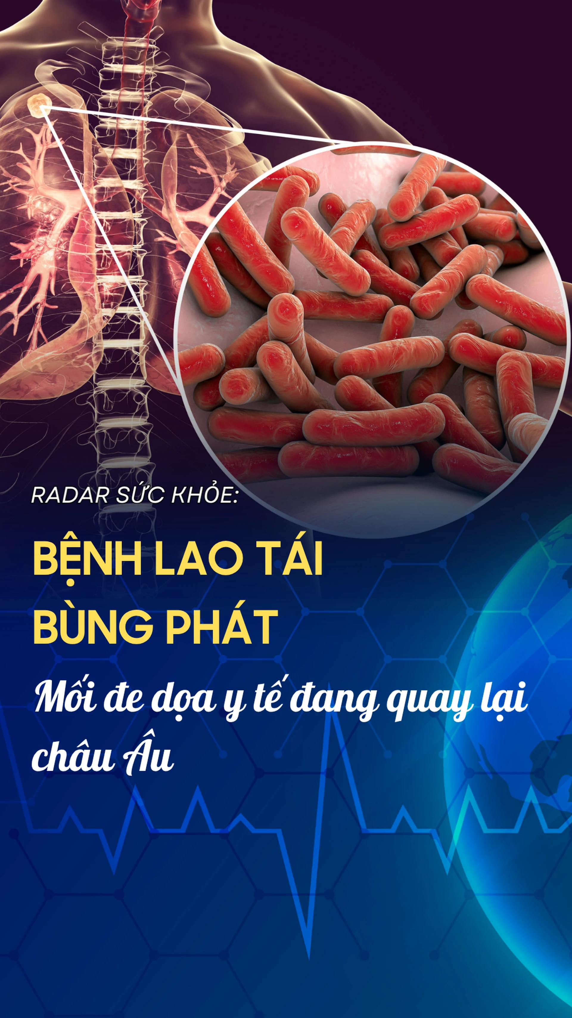 benh_lao_tai_bung_phat_moi_de_doa_y_te_dang_quay_lai_chau_au_407f300d16