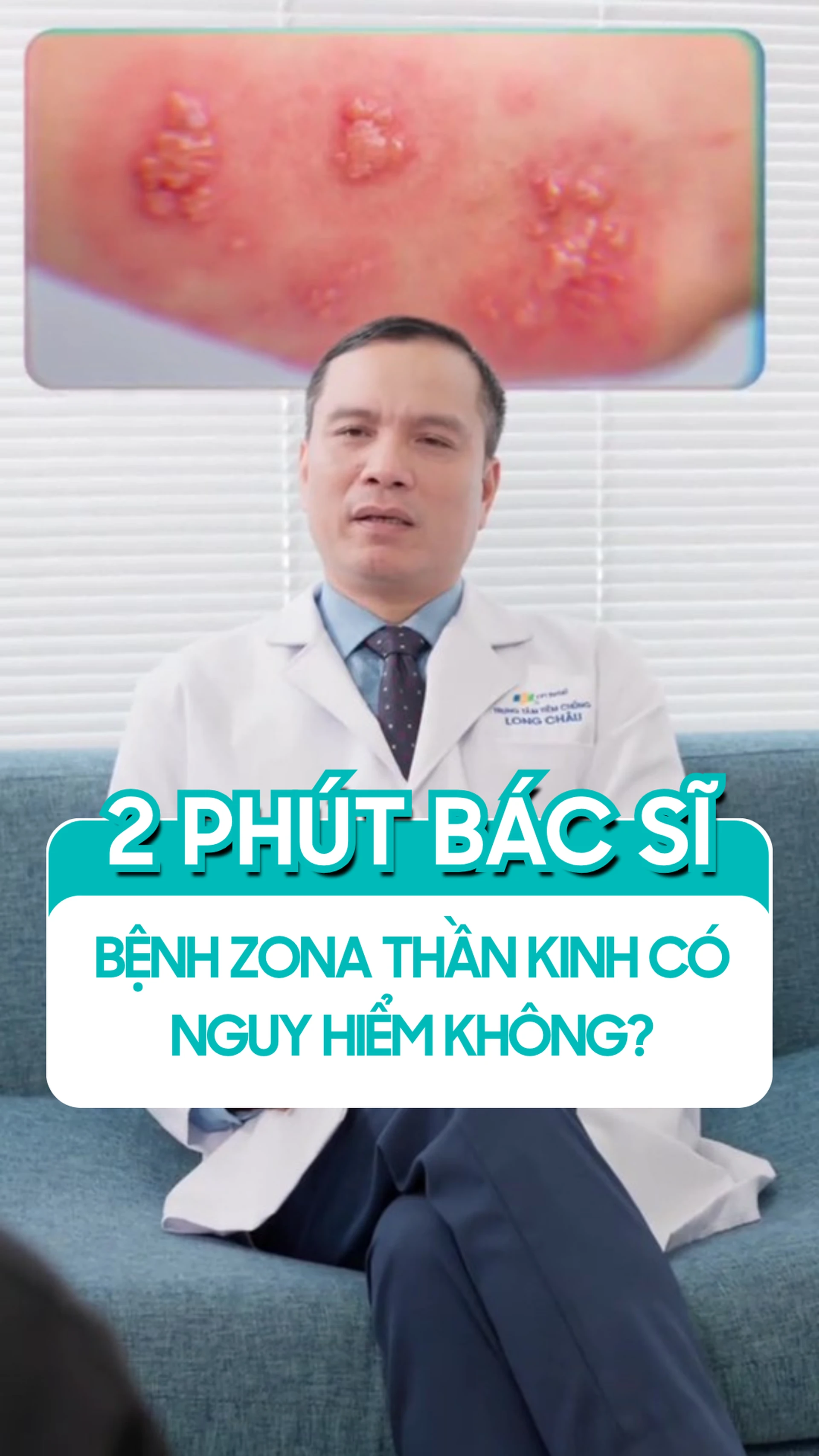 benh_zona_than_kinh_co_nguy_hiem_khong_443703e5f0