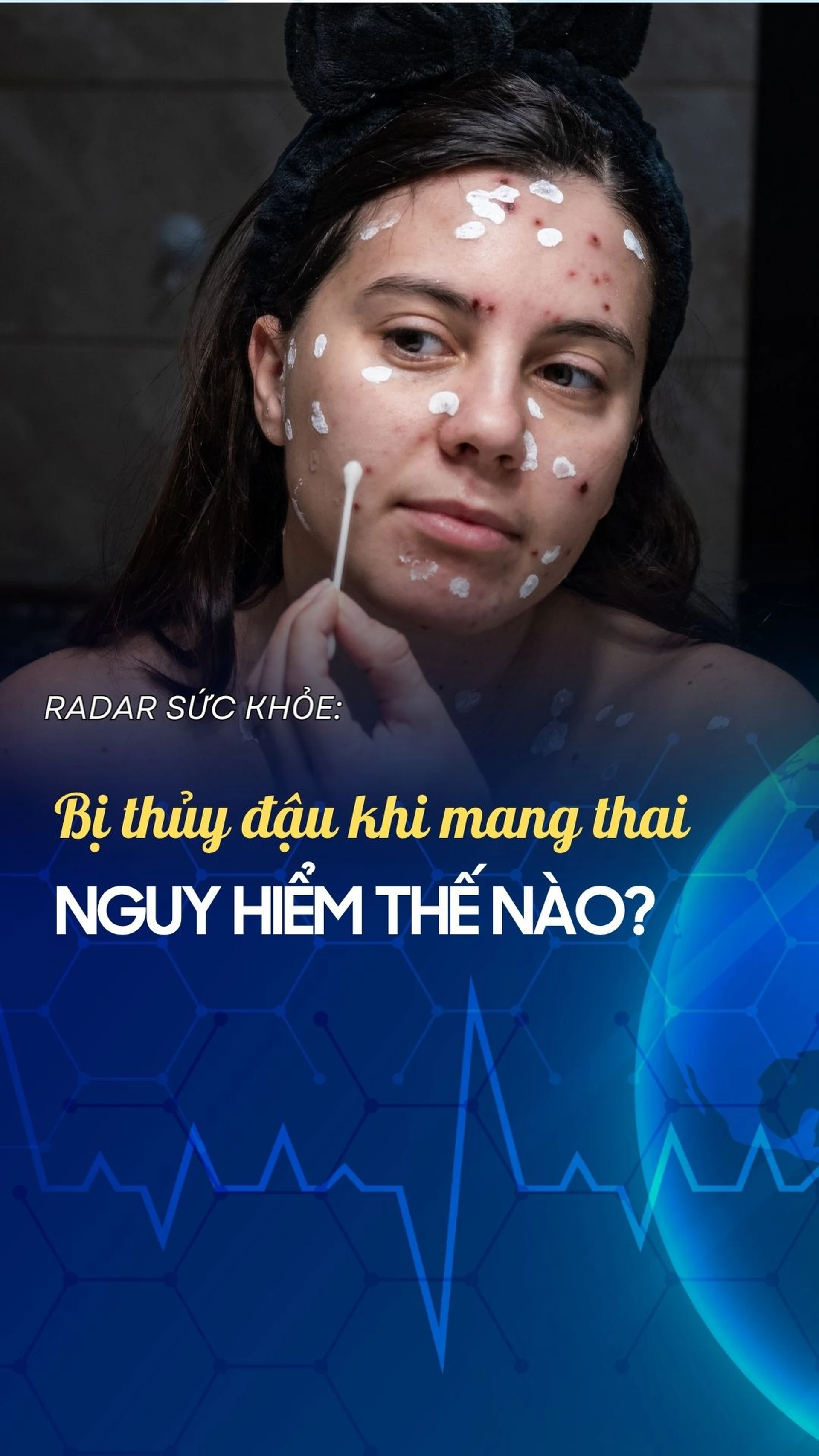 bi_thuy_dau_khi_mang_thai_nguy_hiem_ra_sao_73e43e7c80