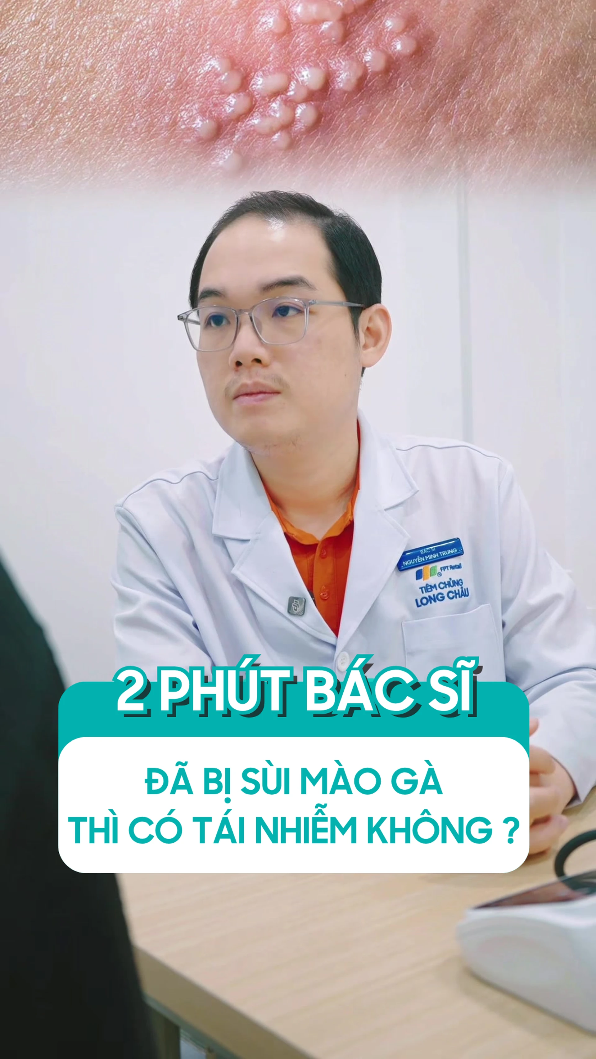 da_bi_sui_mao_ga_thi_co_tai_nhiem_khong_7a62489143