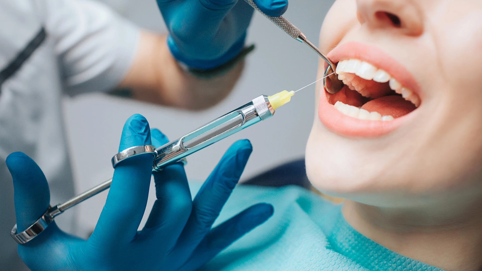 Gây tê cận chóp: Giải pháp giảm đau hiệu quả trong nha khoa