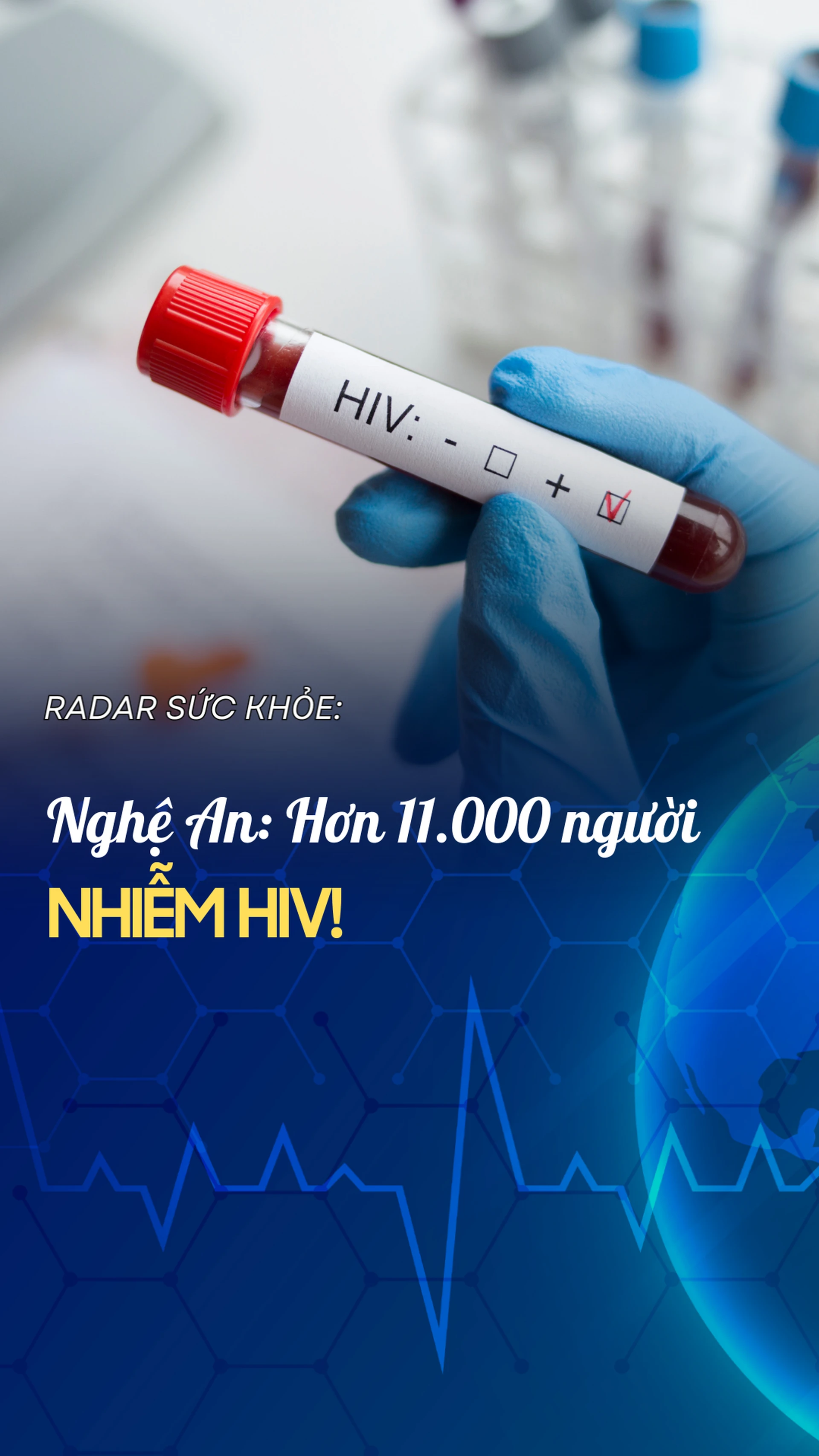 hon_11_000_nguoi_o_nghe_an_nhiem_hiv_155da9630b