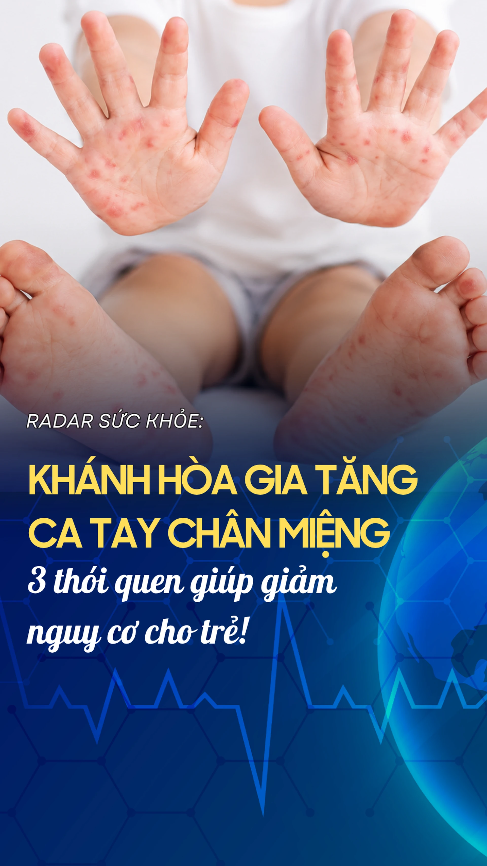 khanh_hoa_gia_tang_ca_tay_chan_mieng_3_thoi_quen_giup_giam_nguy_co_cho_tre_10009_a99fd4c0ae_d1444b566c
