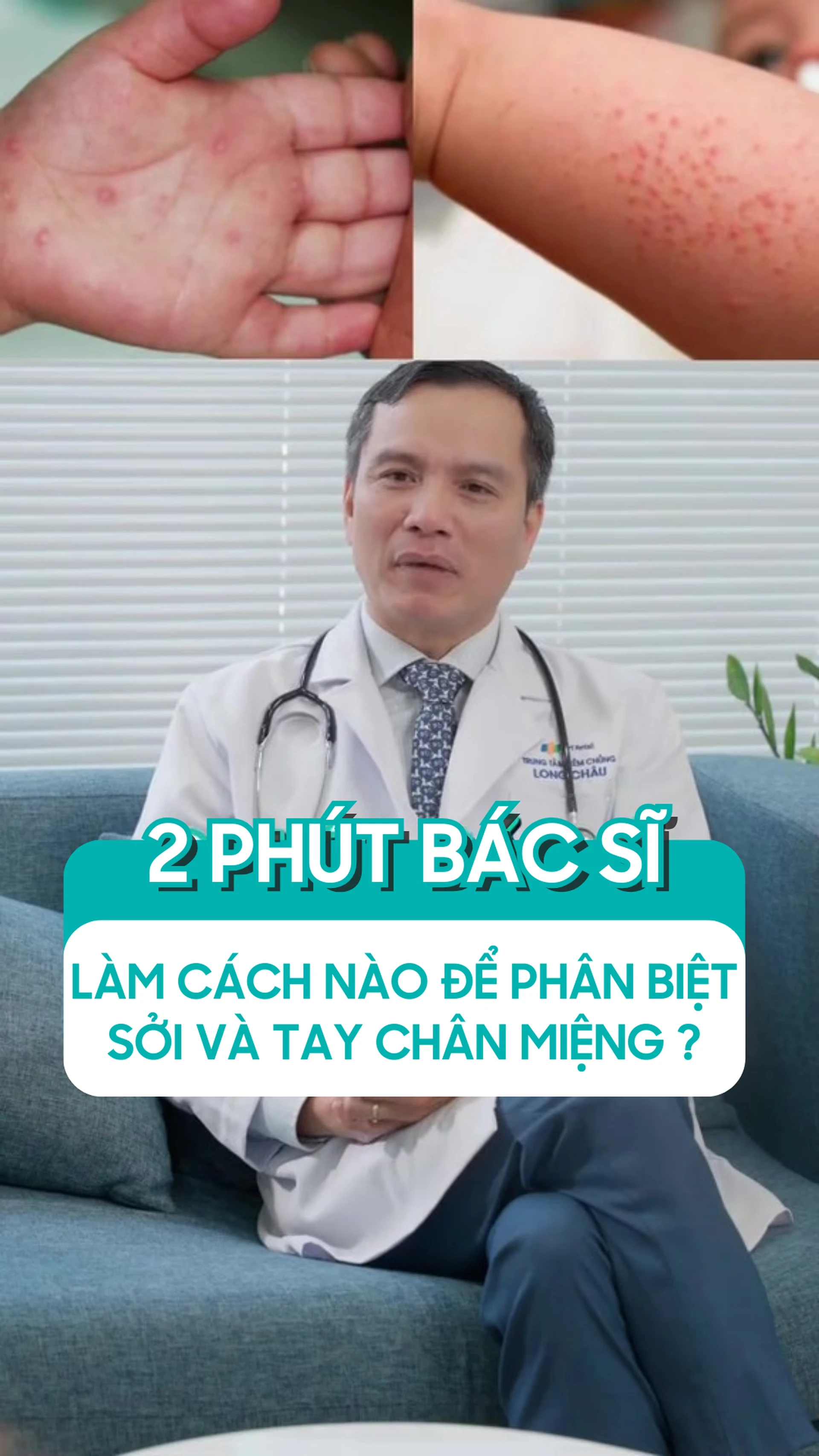 lam_cach_nao_de_phan_biet_soi_va_tay_chan_mieng_0468058a88