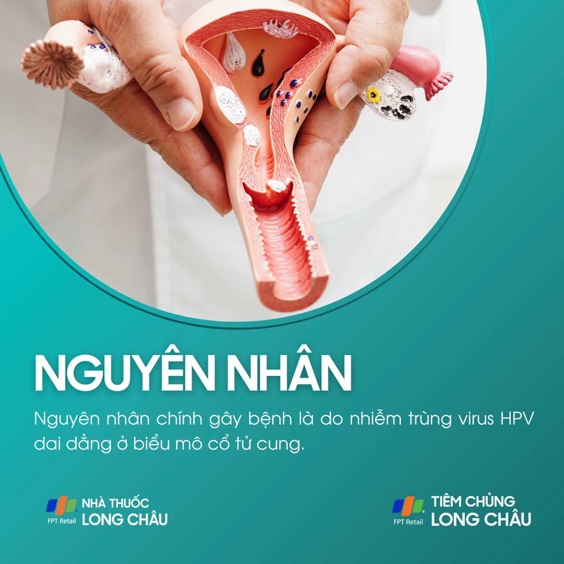 loan_san_co_tu_cung_3_cfb26e6faa