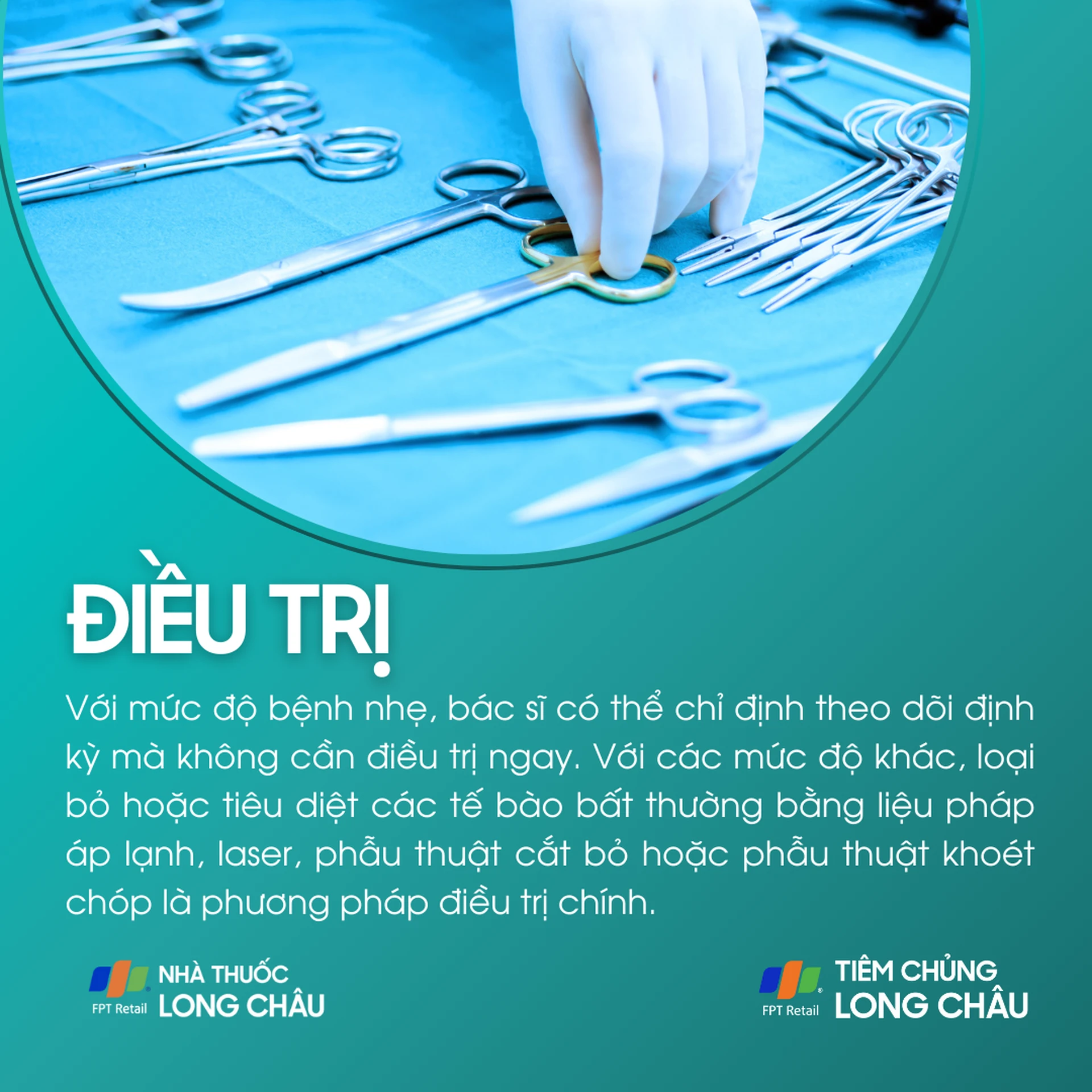 loan_san_co_tu_cung_6_874a1371cf
