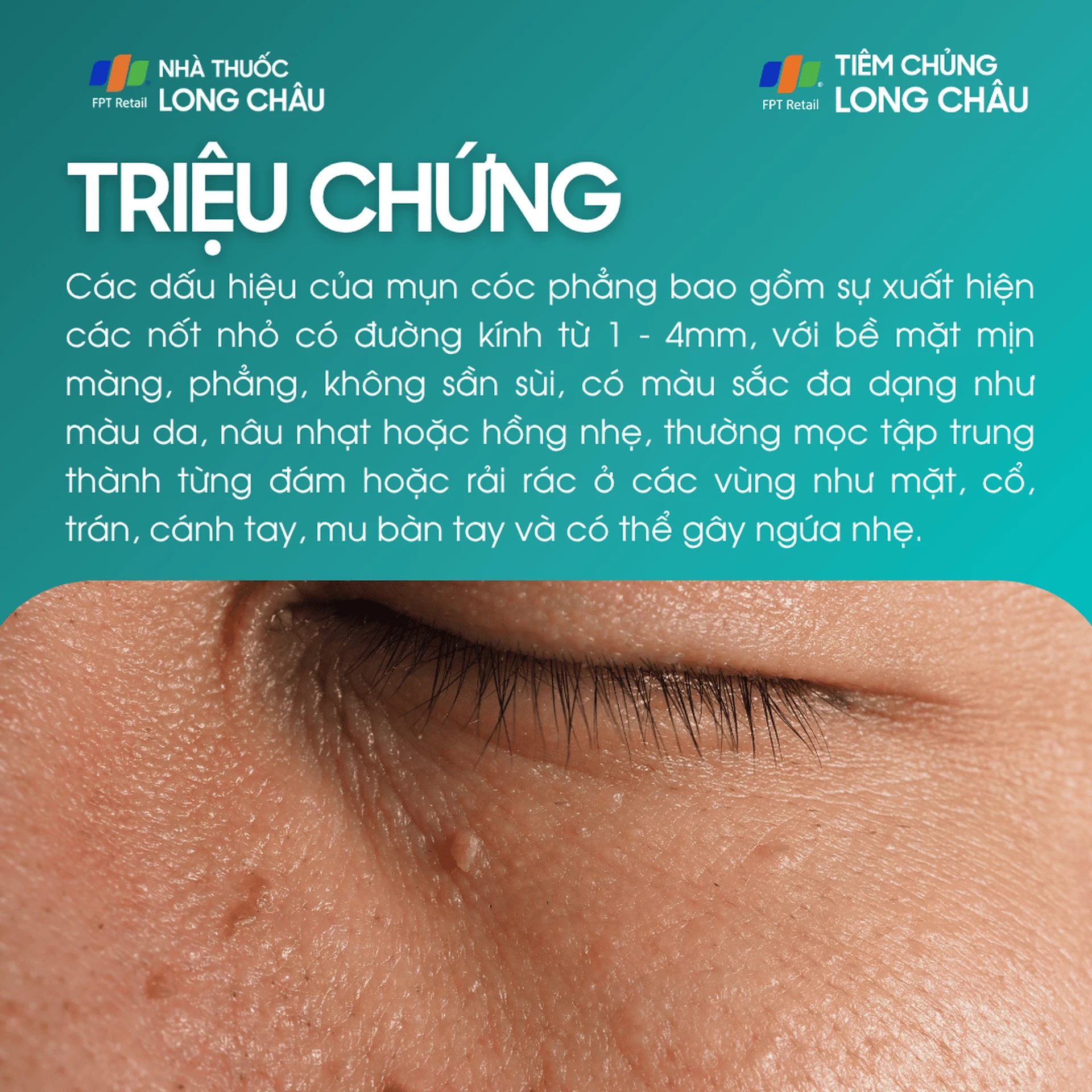 mun_coc_phang_2_7a84c84ea9