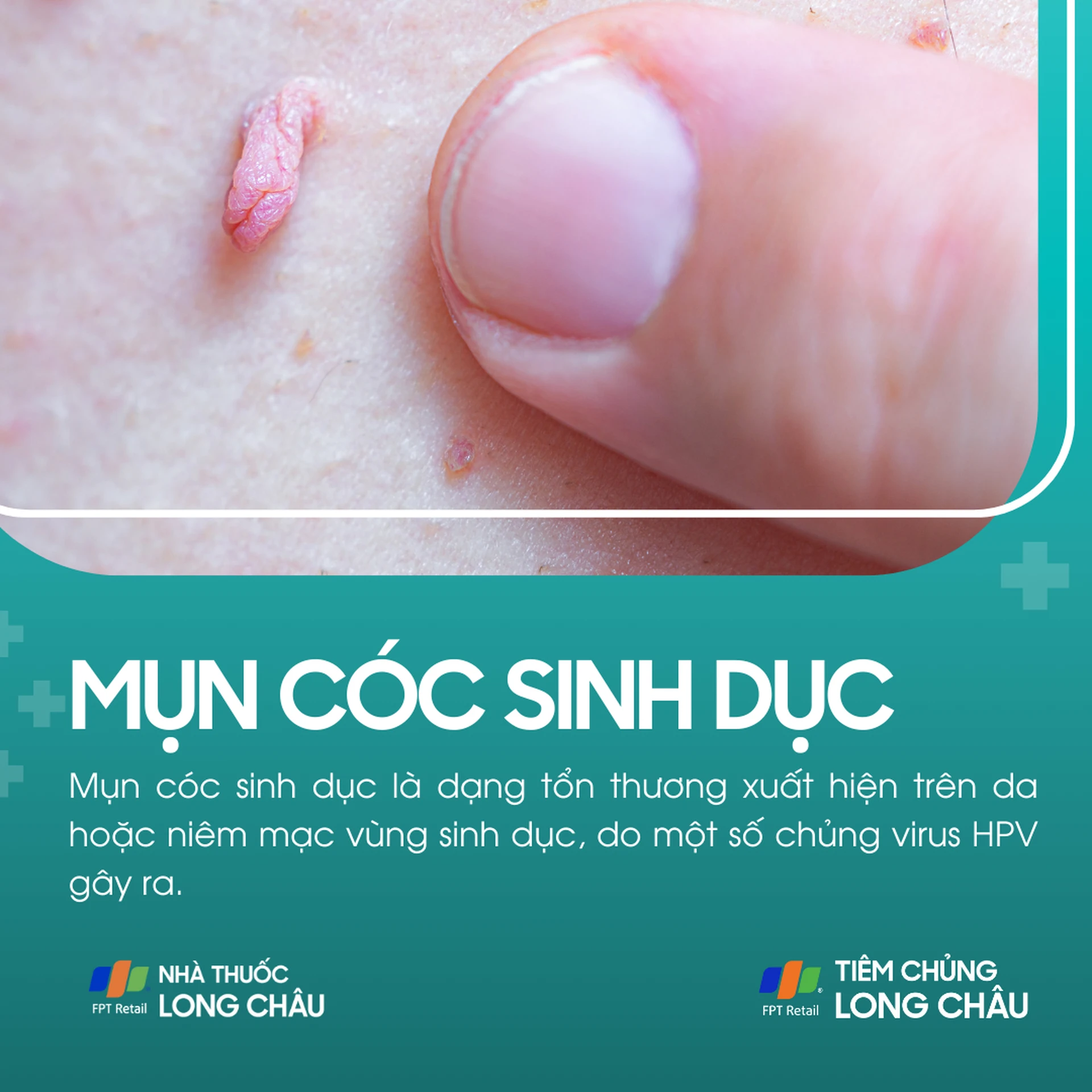 mun_coc_sinh_duc_1_1938a1c86e