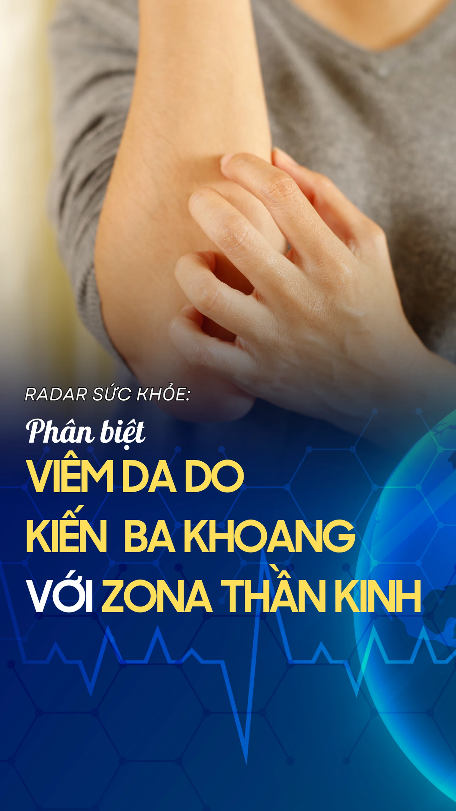 nhieu_nguoi_nham_viem_da_do_kien_ba_khoang_voi_zona_than_kinh_dau_la_diem_khac_biet_10009_1_c7dc47ad94