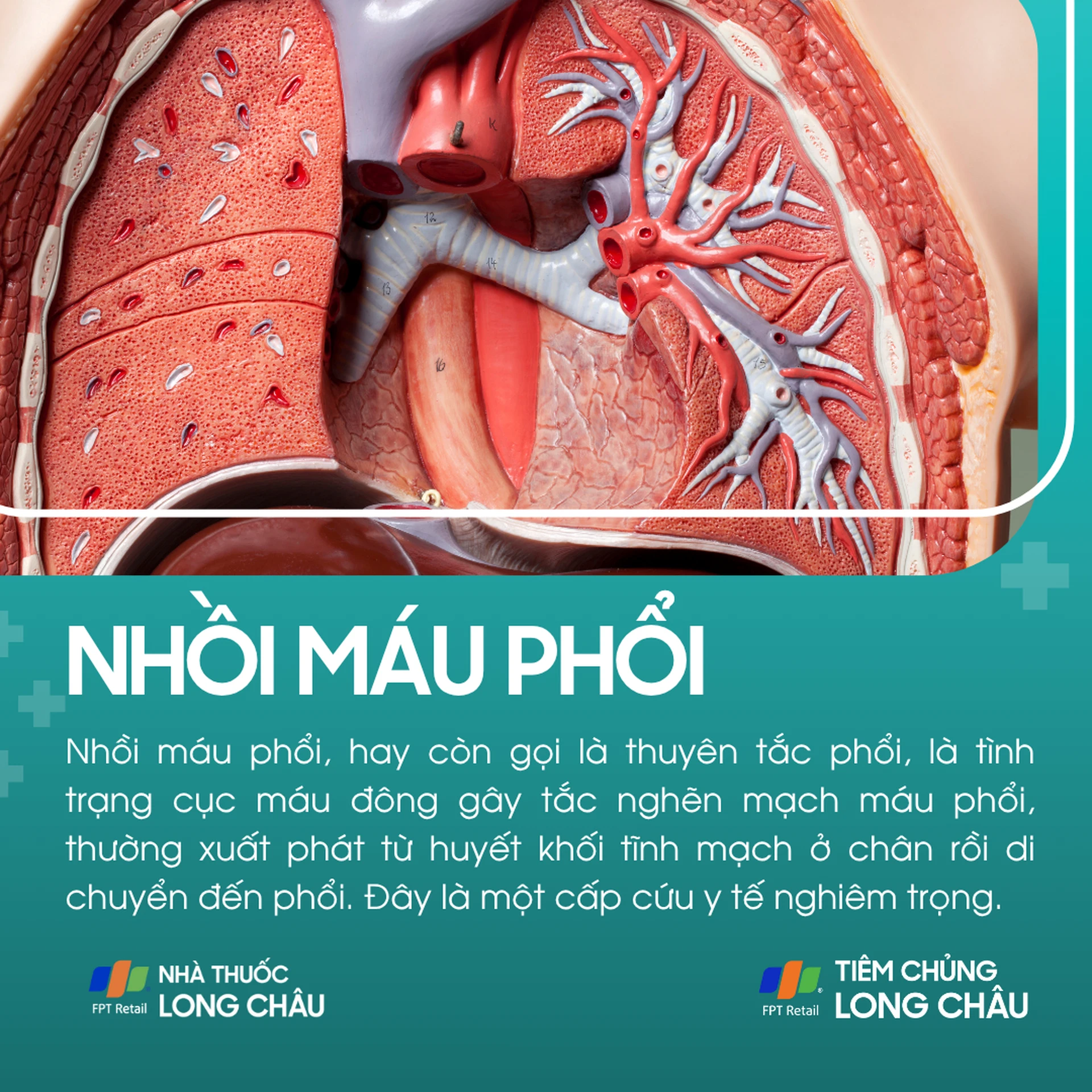 nhoi_mau_phoi_1_11590fbfde