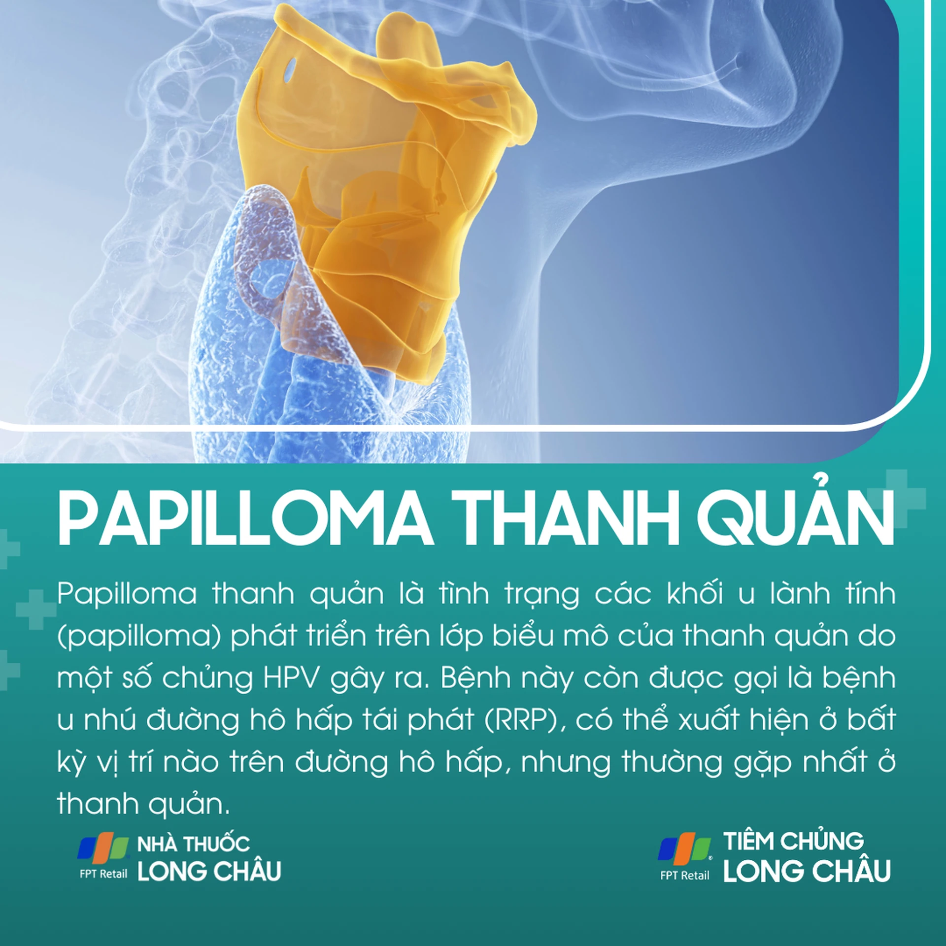 papilloma_thanh_quan_1_7b67e8f321