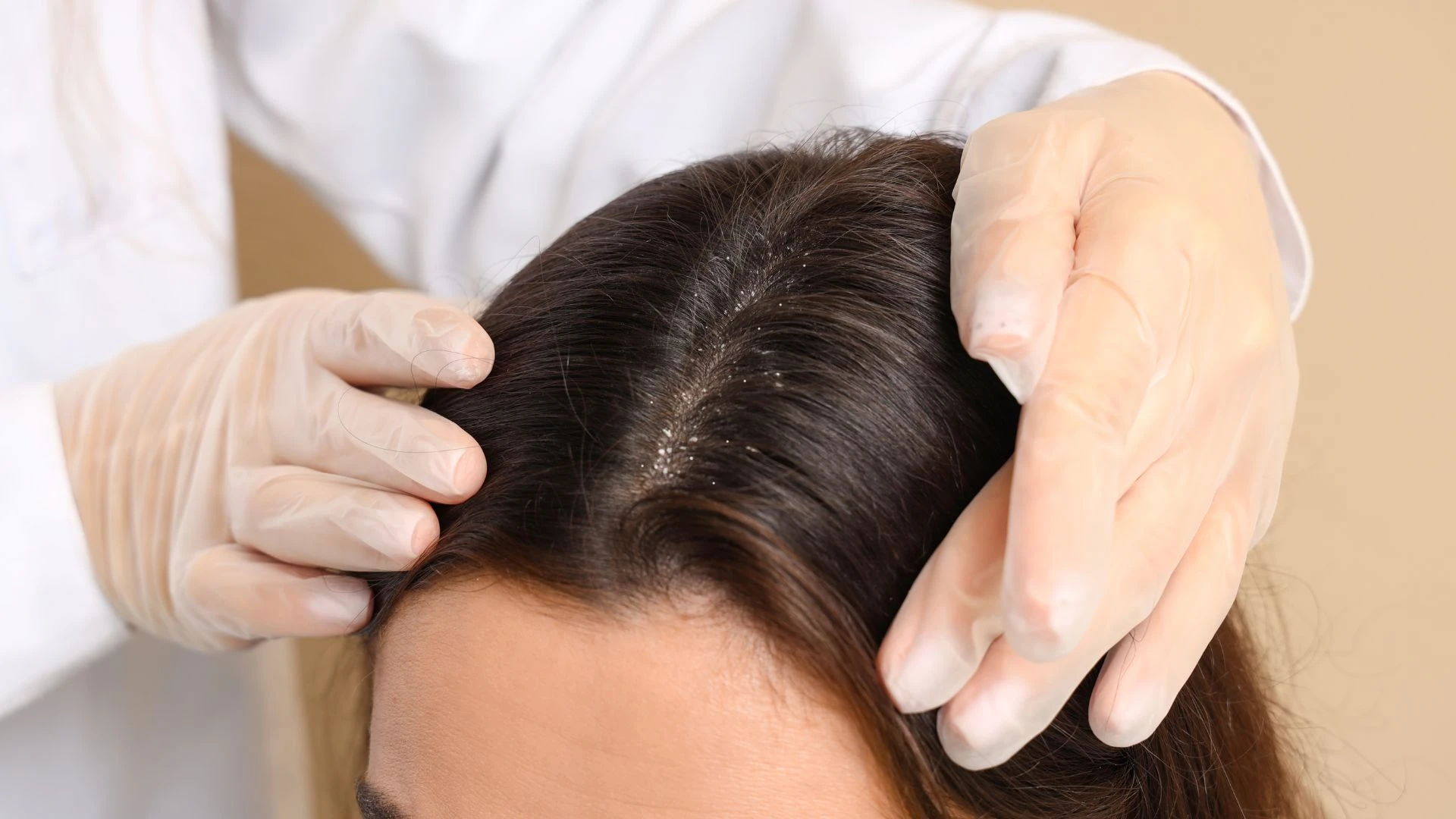 Tẩy tế bào chết da đầu đúng cách: Lợi ích và lưu ý
