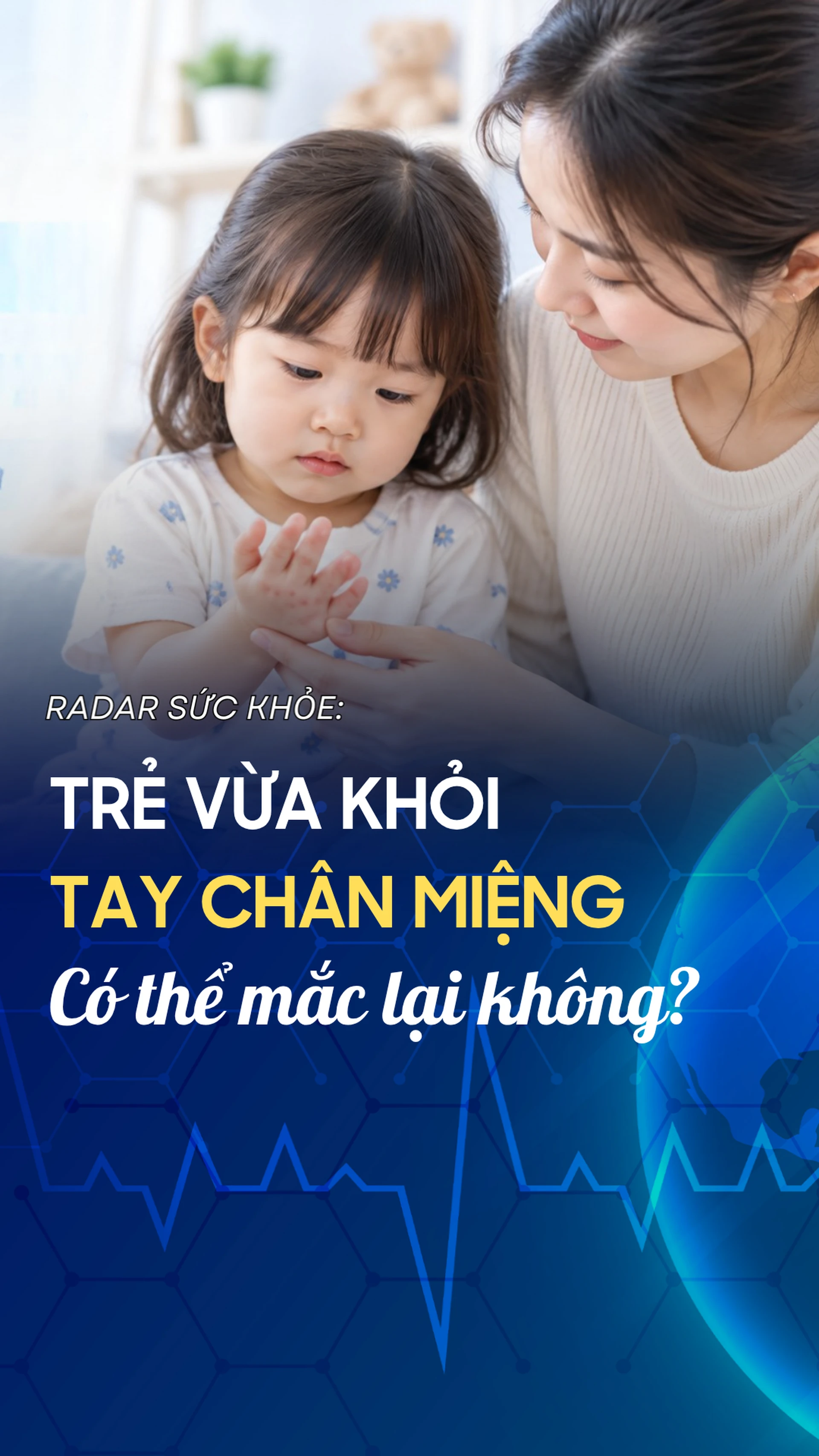 tre_vua_khoi_tay_chan_mieng_co_the_mac_lai_khong_10009_62cd59c578
