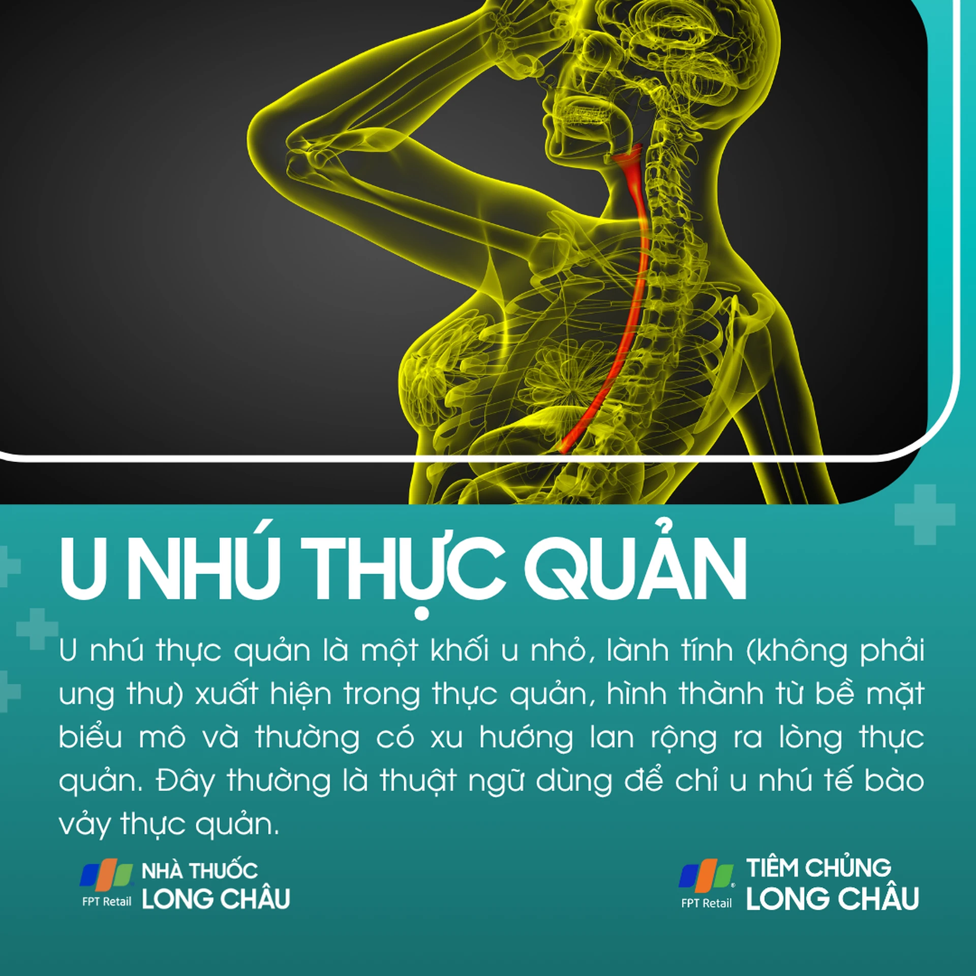 u_nhu_thuc_quan_1_f0bb3efa2e
