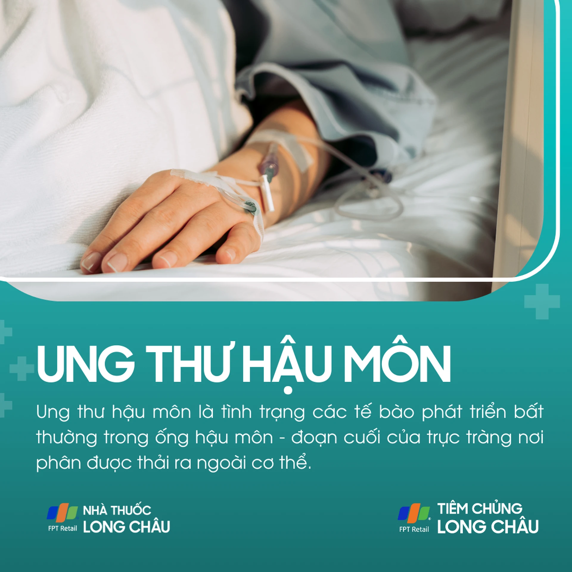 ung_thu_hau_mon_1_1ef8d665c1