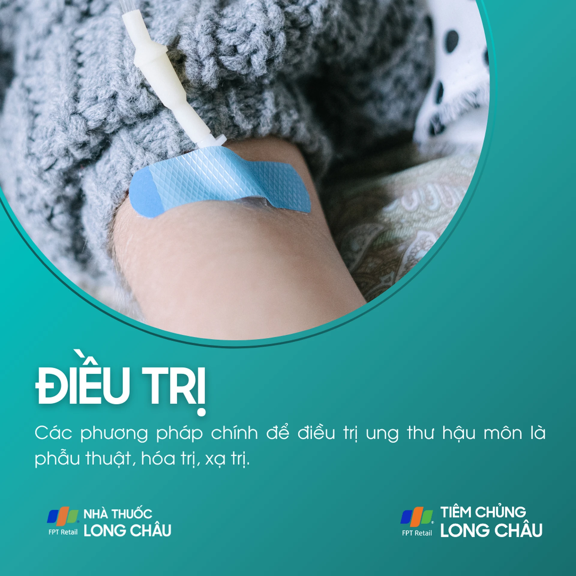 ung_thu_hau_mon_6_e50a21d78a