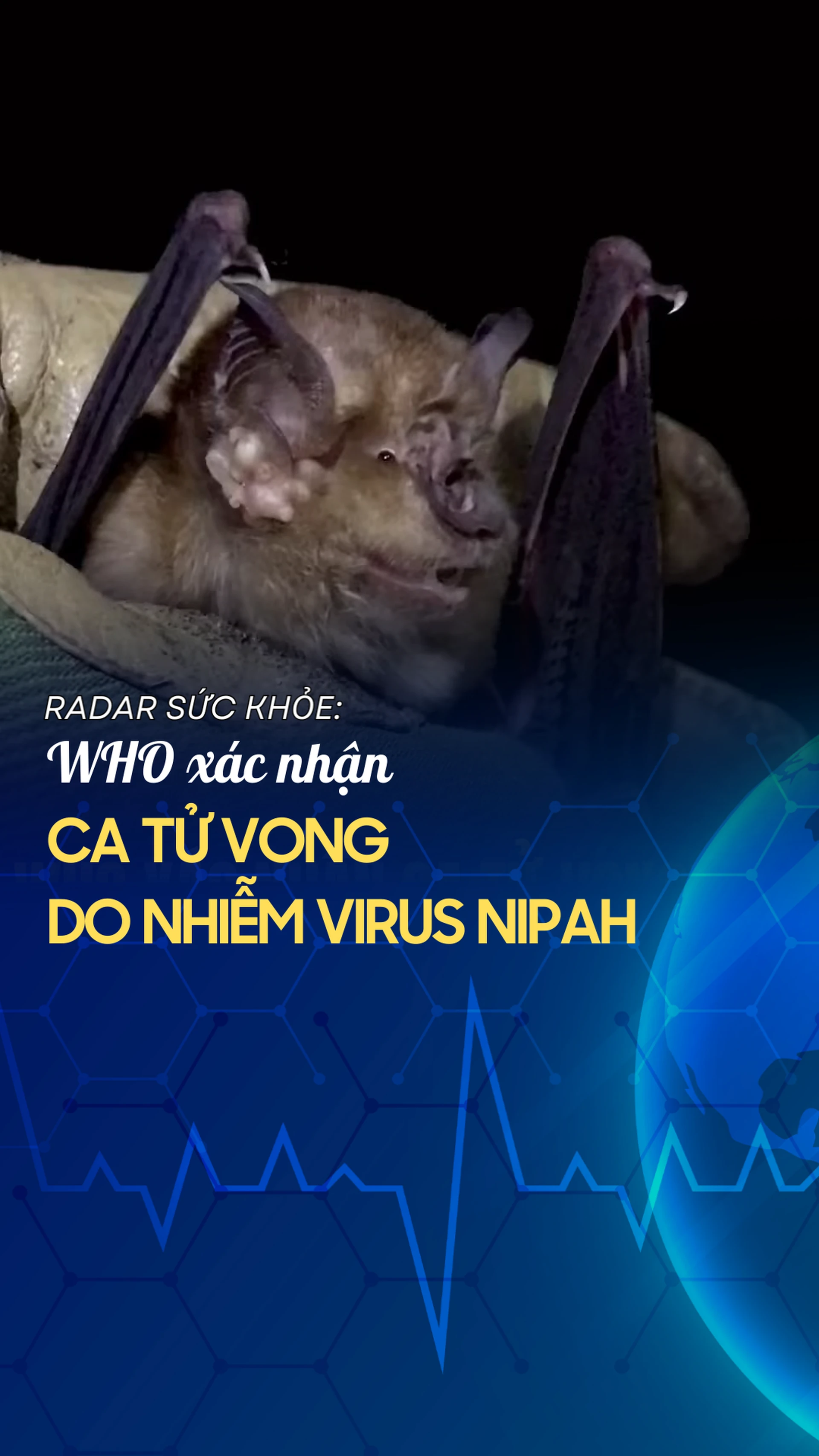 who_xac_nhan_ca_tu_vong_do_nhiem_virus_nipah_6f622a3031
