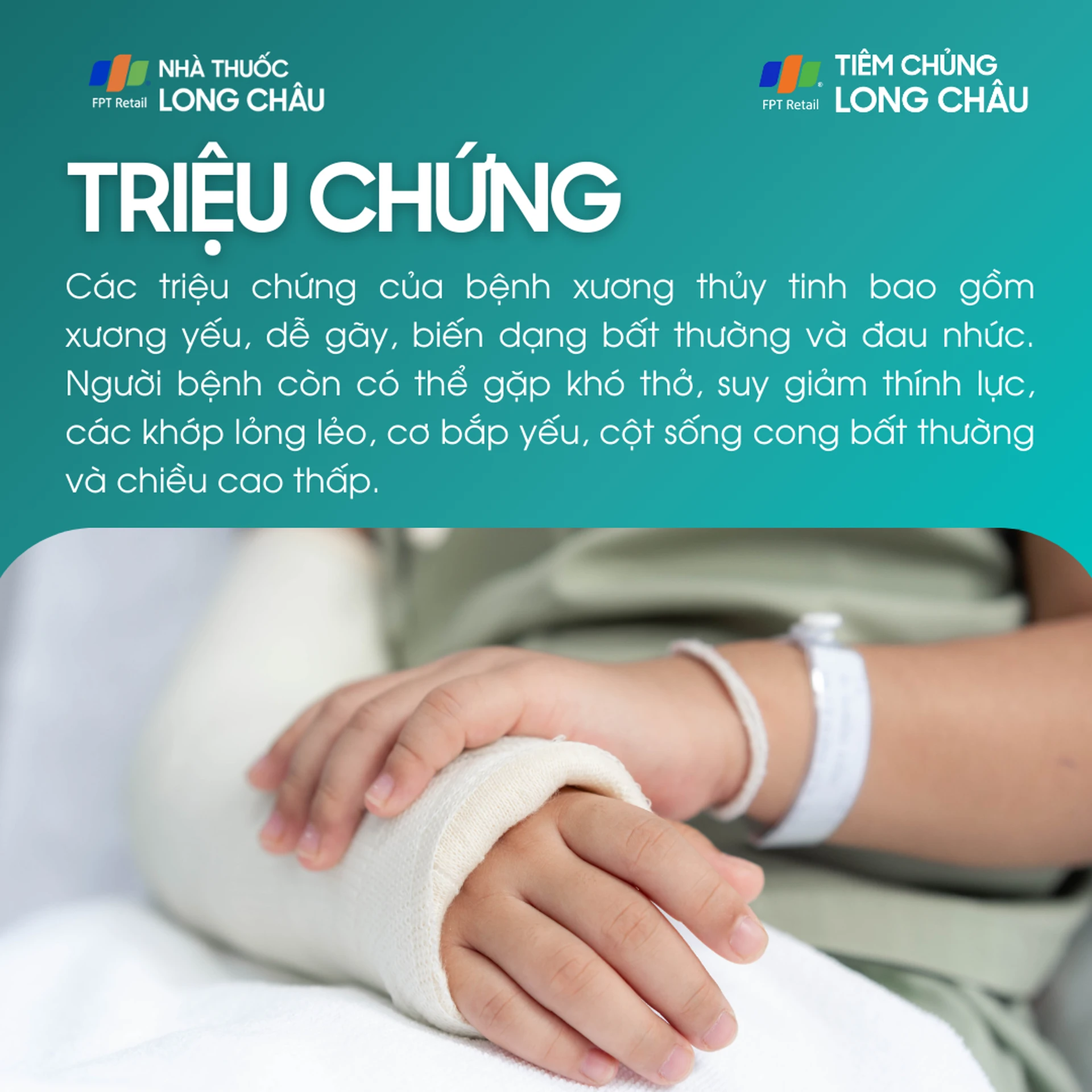 xuong_thuy_tinh_2_a494d7c306