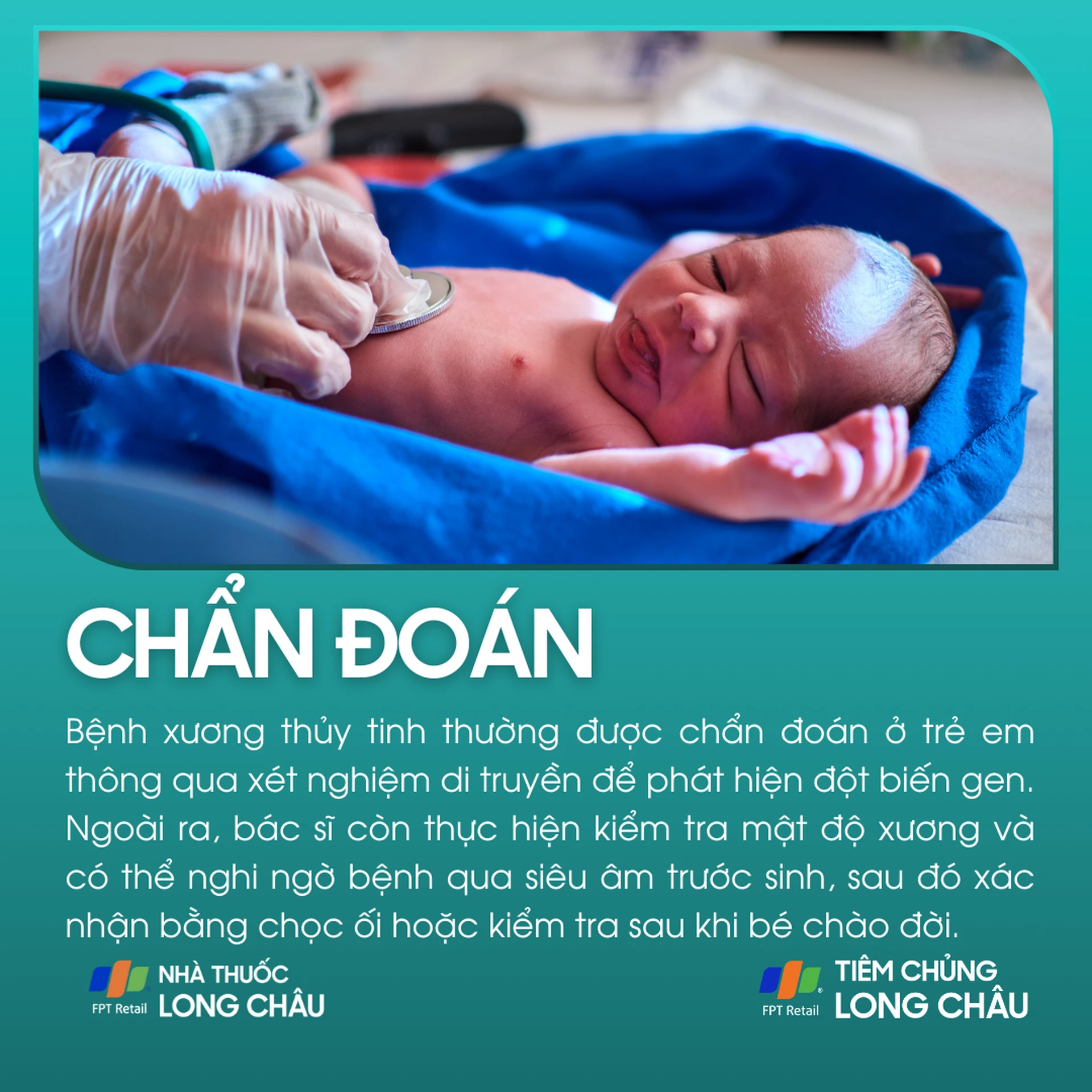 xuong_thuy_tinh_5_b4b222e4ab