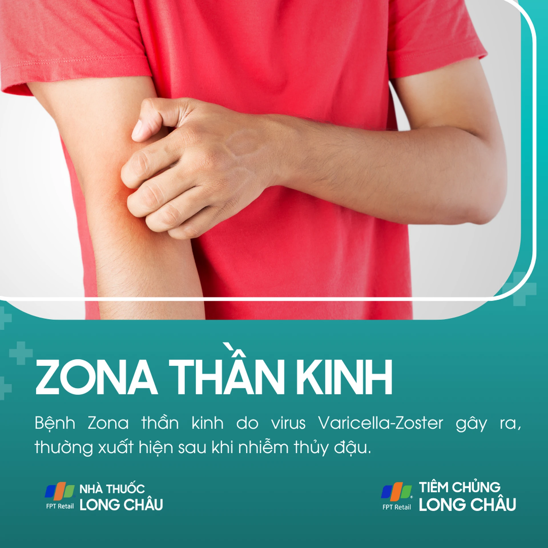 zona_than_kinh_1_c7cf5eeede