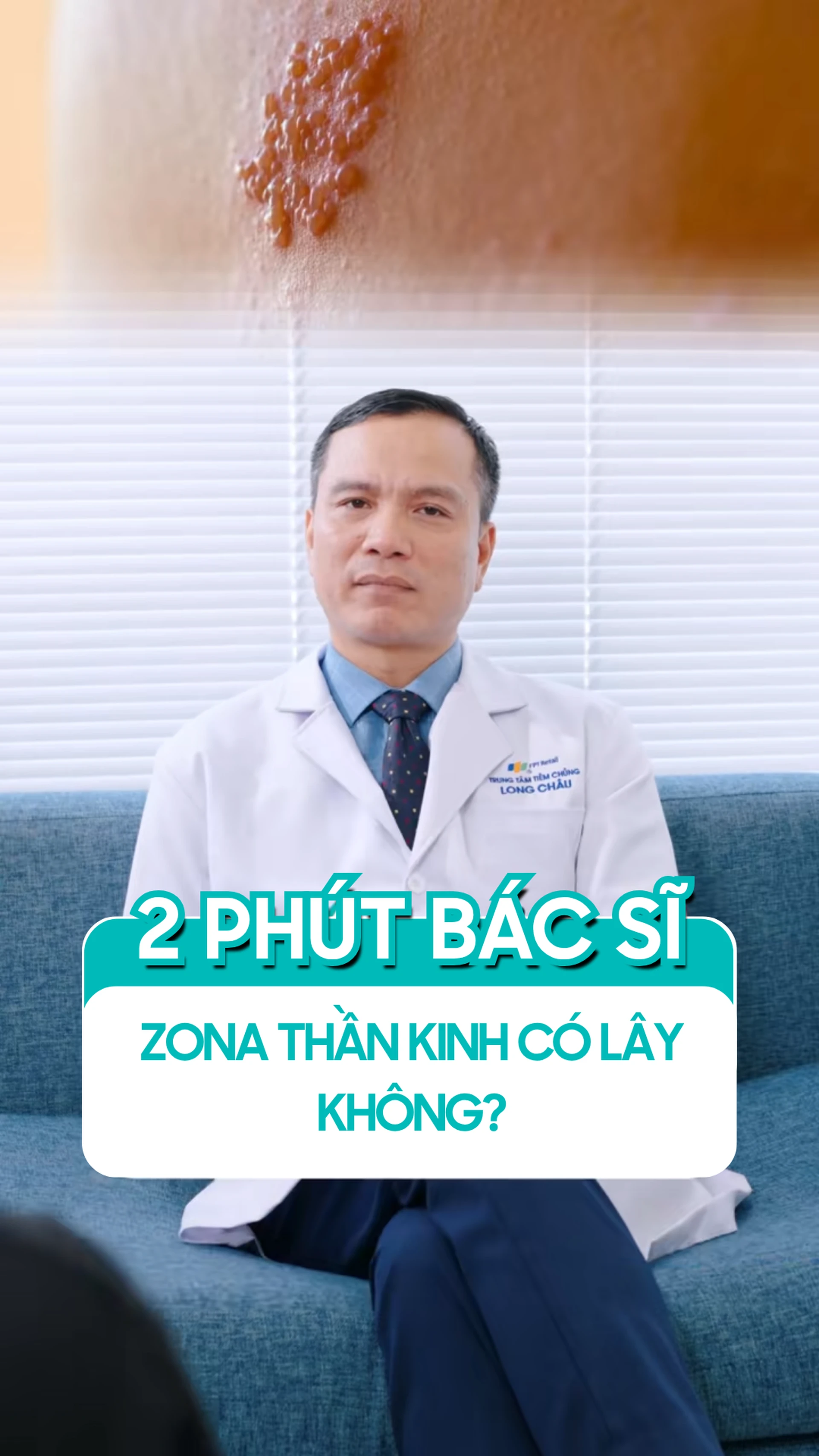 zona_than_kinh_co_lay_cho_nguoi_khac_khong_49444c9546