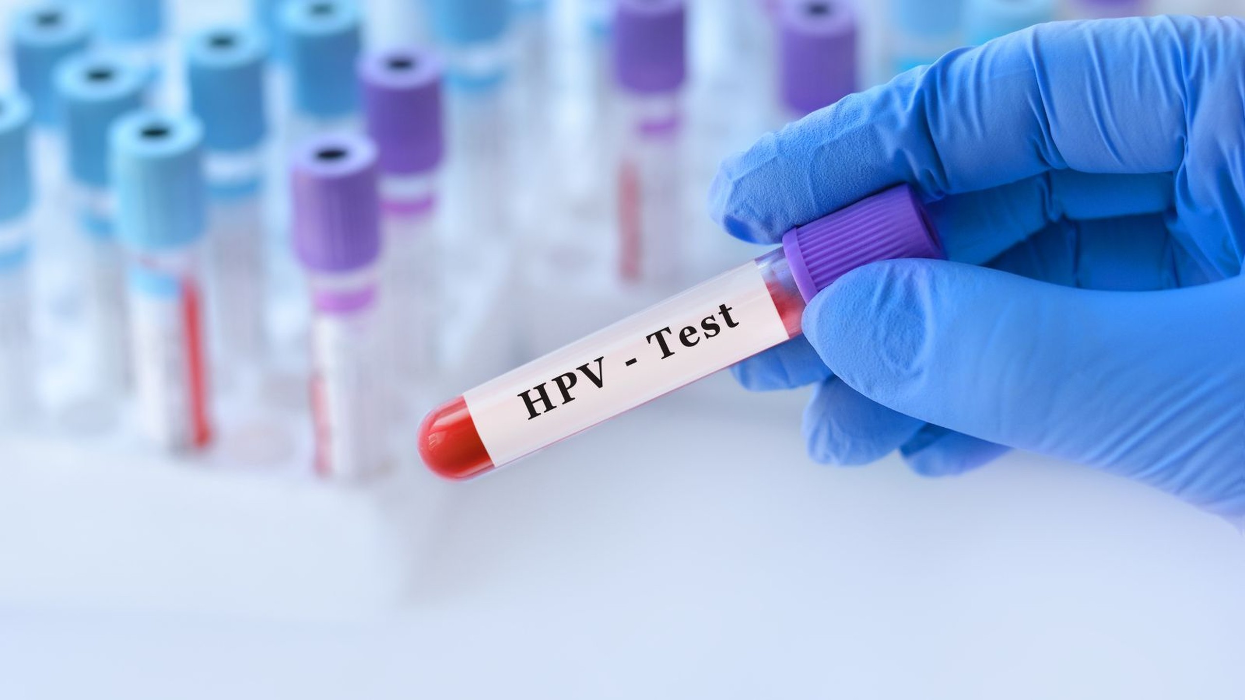 Cách đào thải virus HPV ra khỏi cơ thể như thế nào? 4