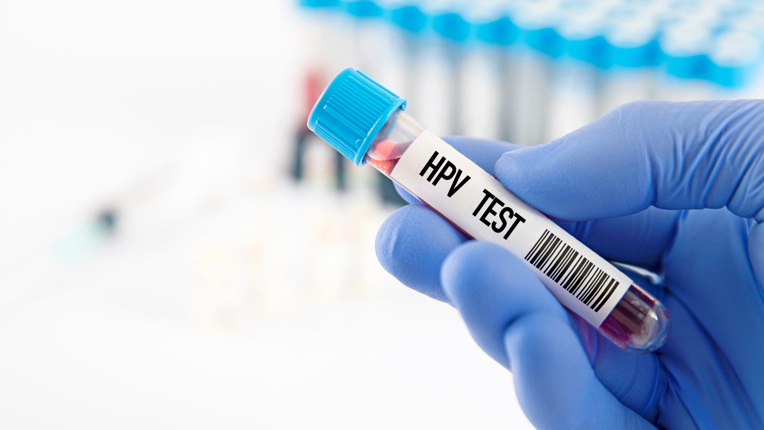Chưa quan hệ có bị nhiễm HPV không? Virus HPV lây nhiễm qua đường nào? 4