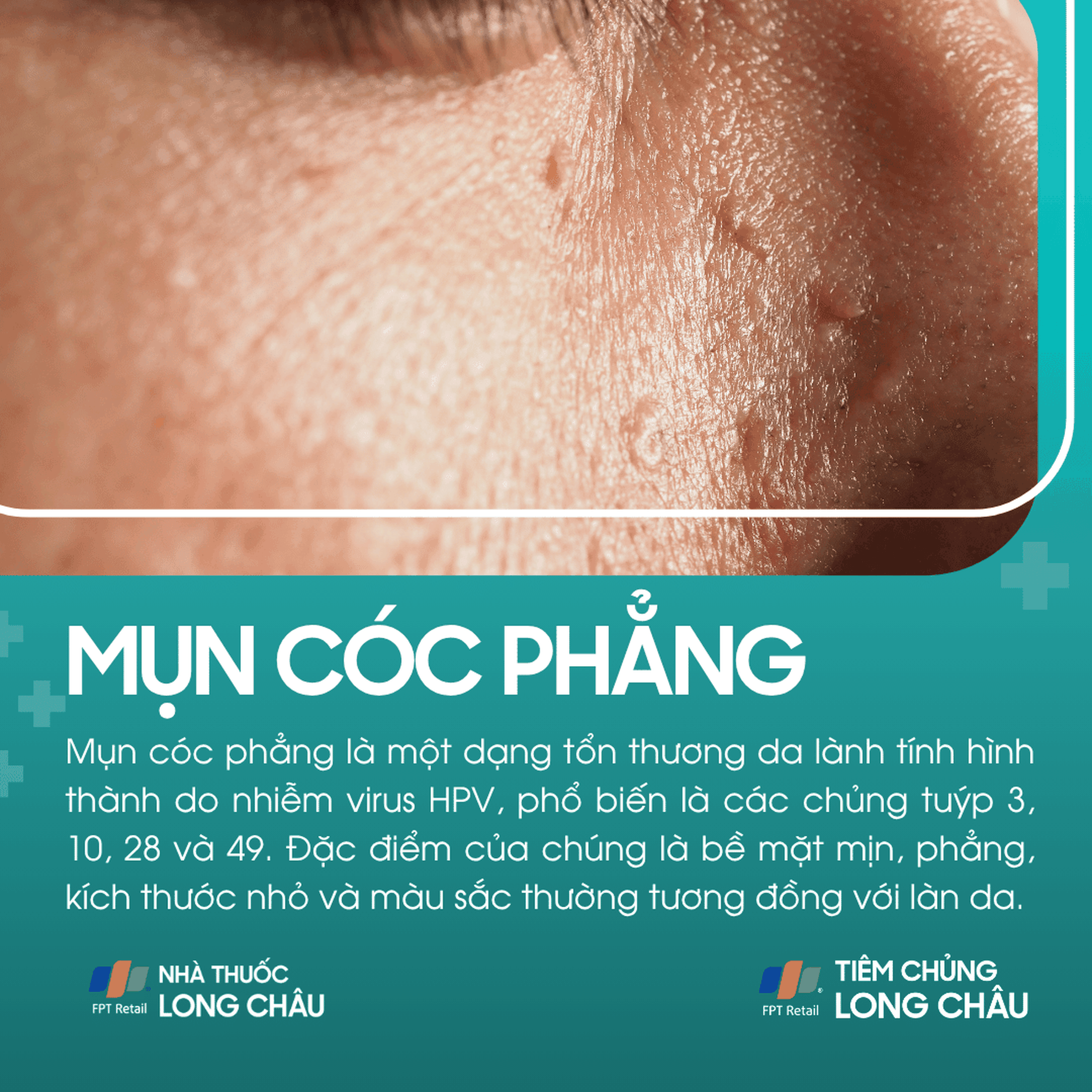 mun_coc_phang_1_c781a1a4b7