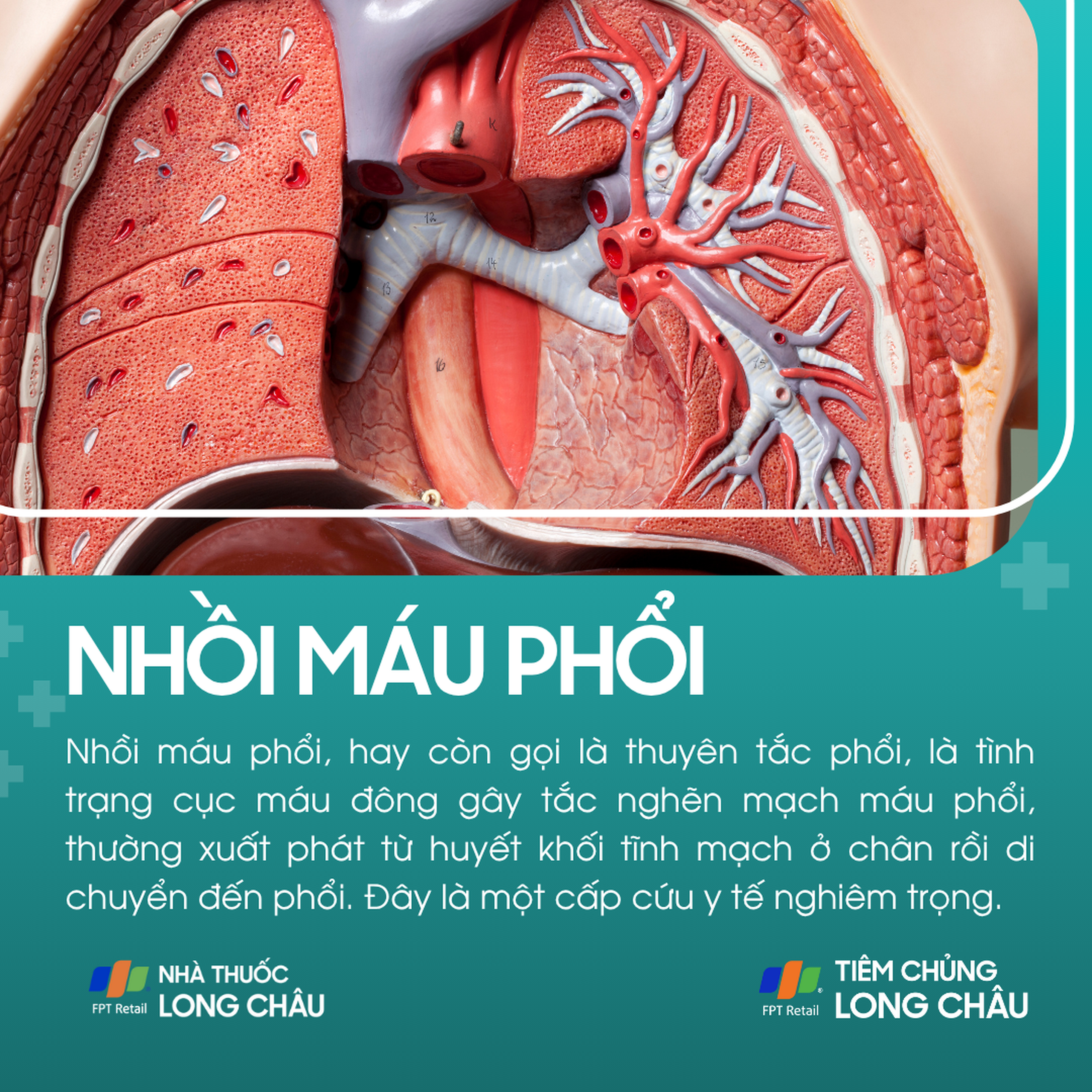 nhoi_mau_phoi_1_11590fbfde