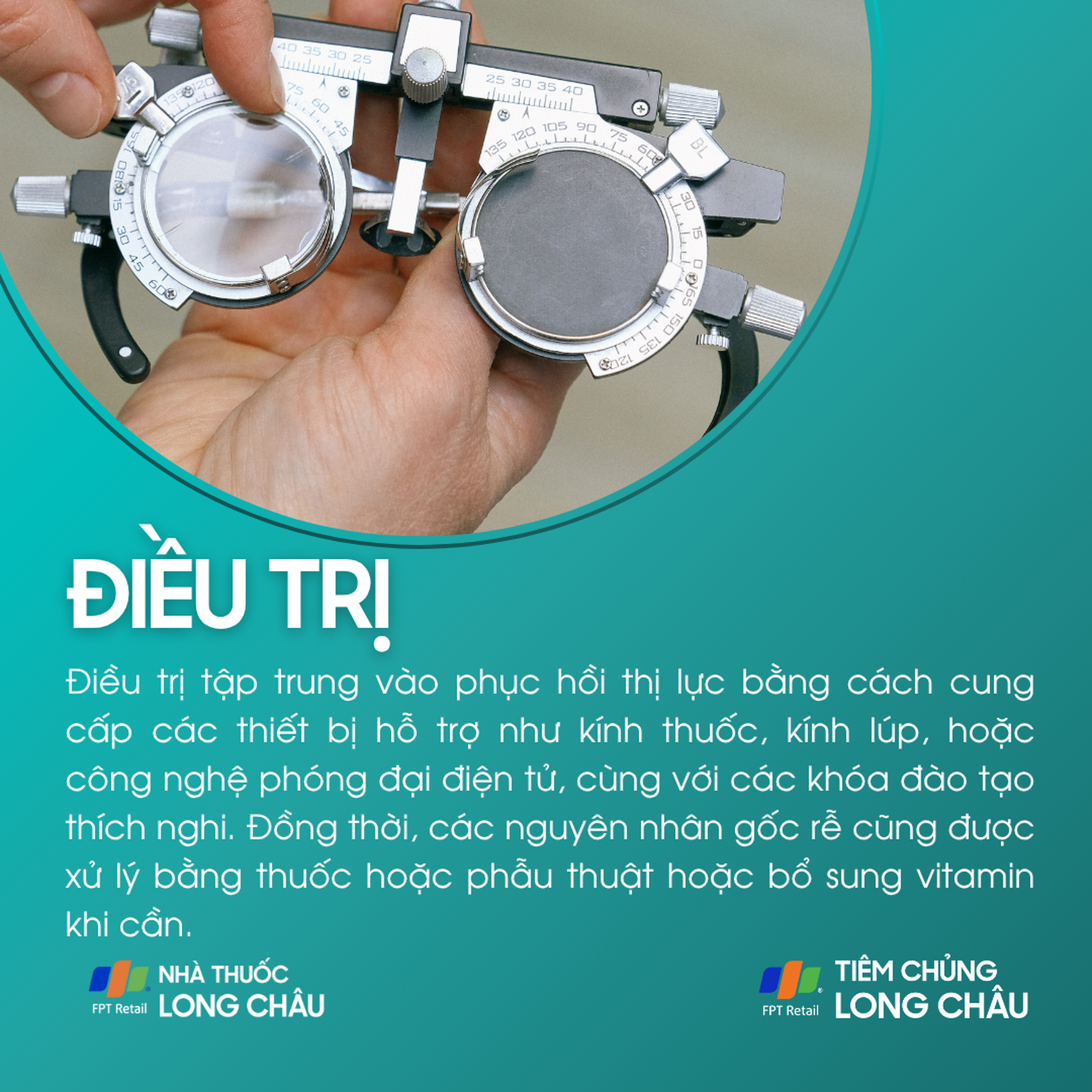 suy_giam_thi_luc_6_a11e616911