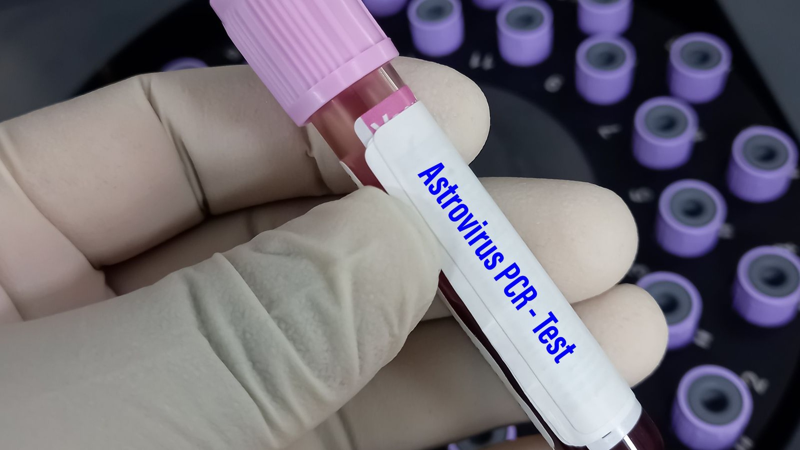 Tìm hiểu virus Astrovirus lây nhiễm qua những con đường nào? 1