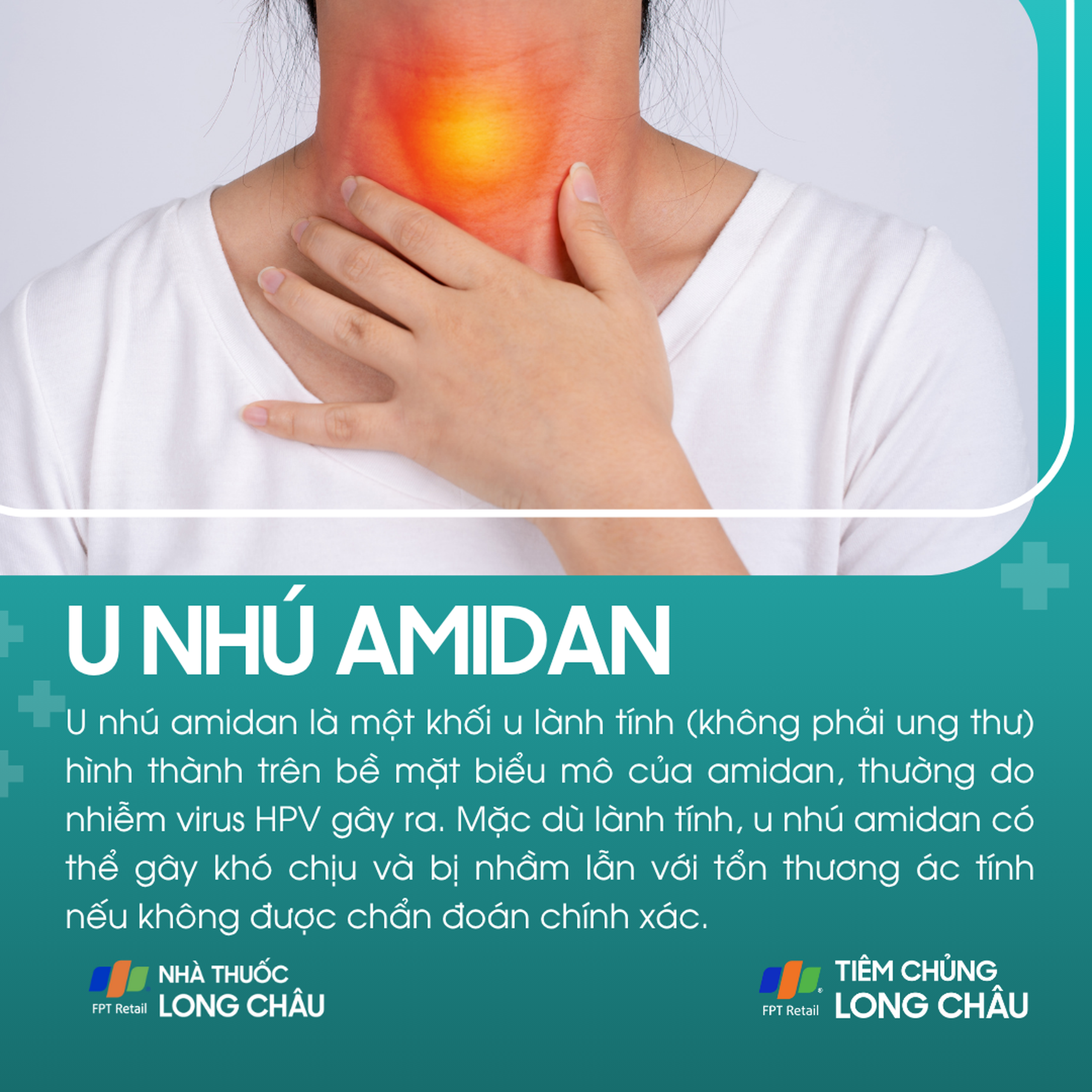 u_nhu_amidan_1_488b336547