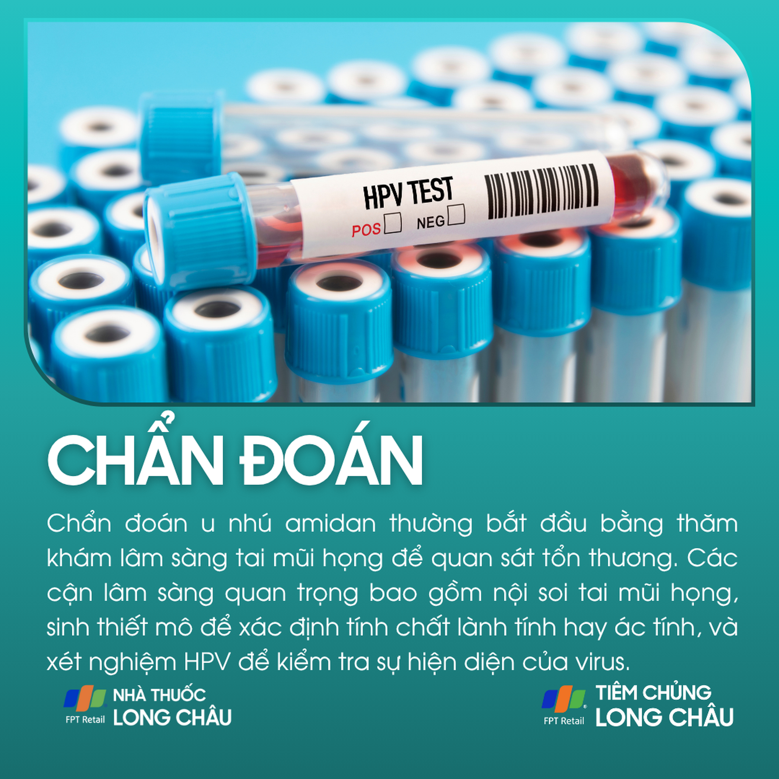 u_nhu_amidan_5_c473ee7226