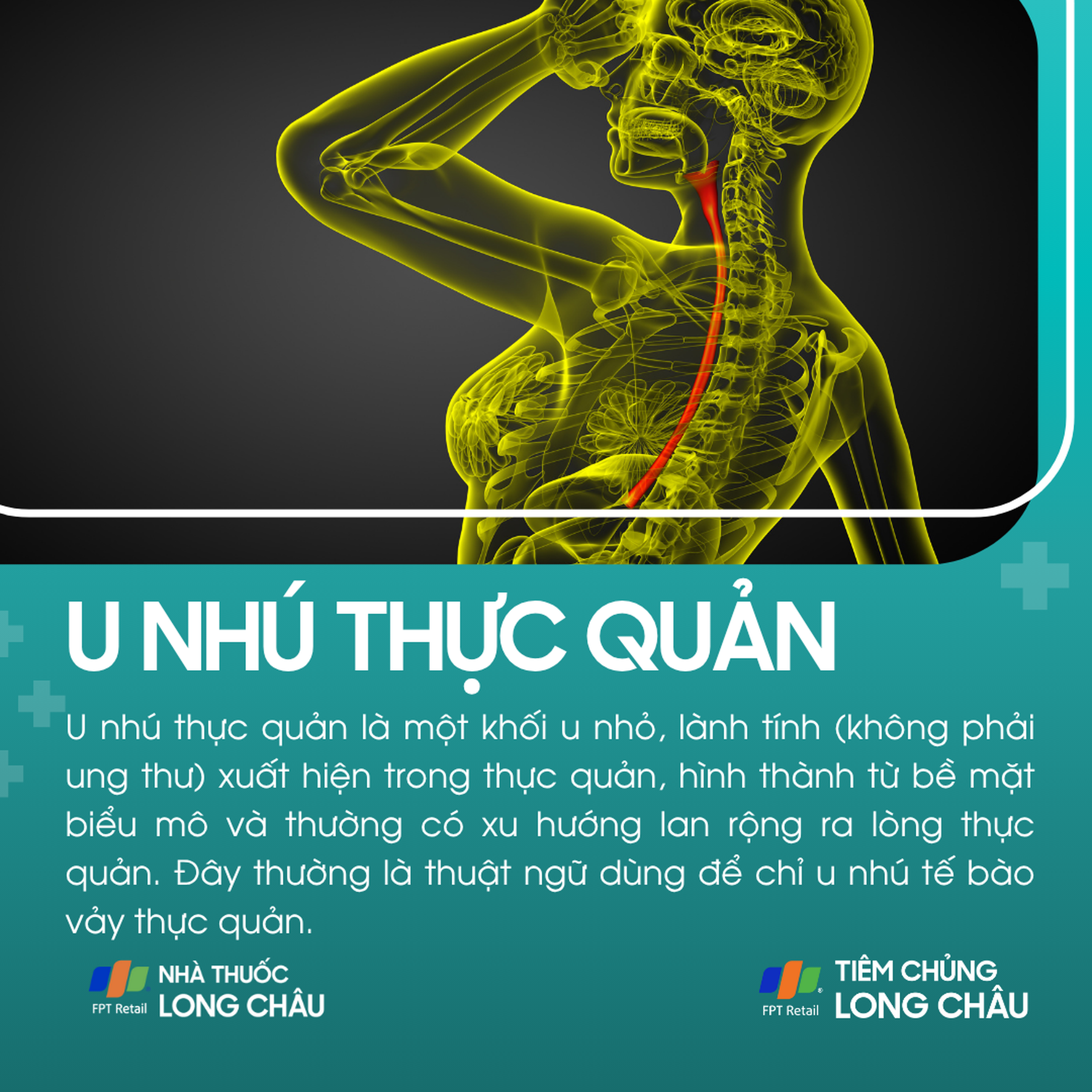 u_nhu_thuc_quan_1_f0bb3efa2e