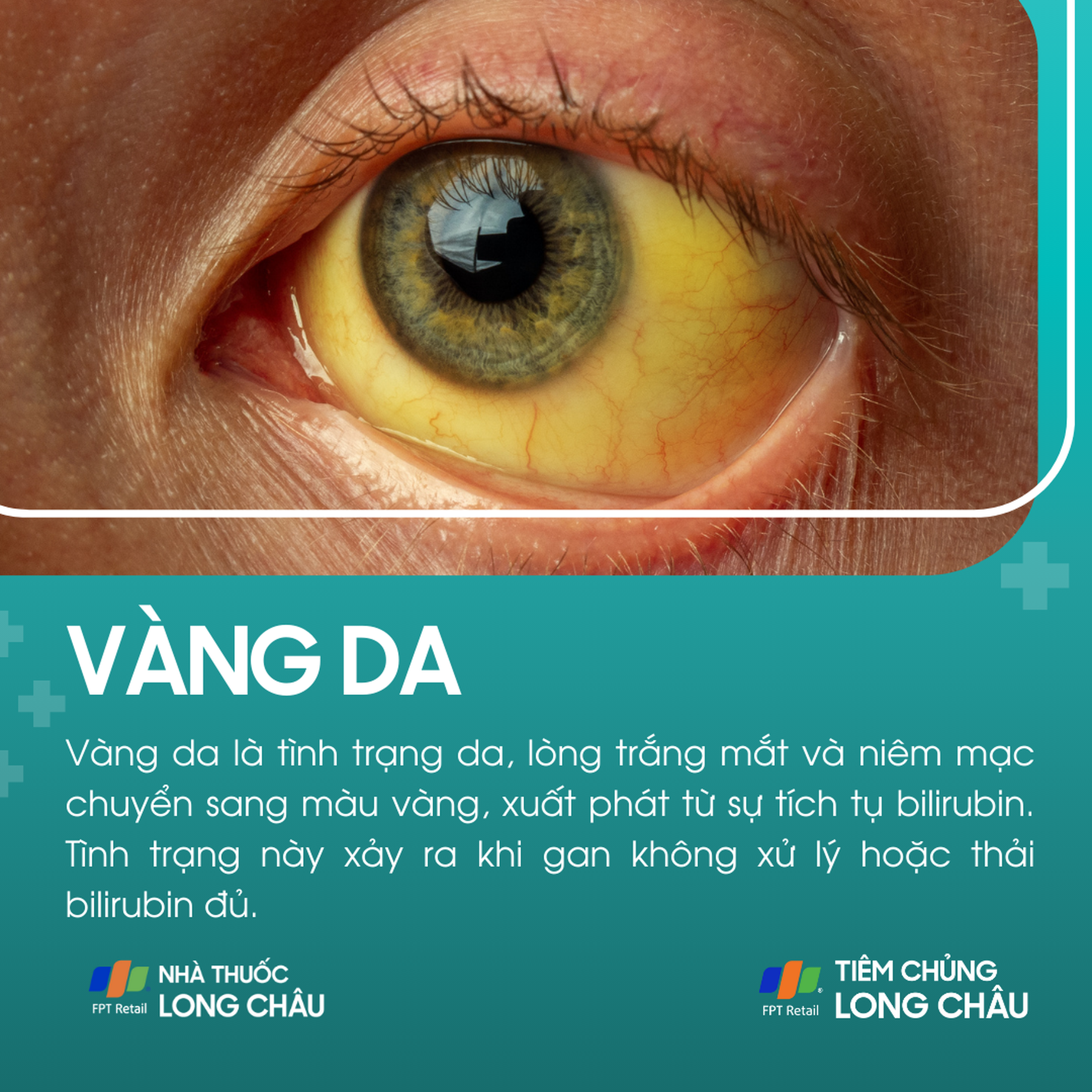 vang_da_1_6f6a0a642c