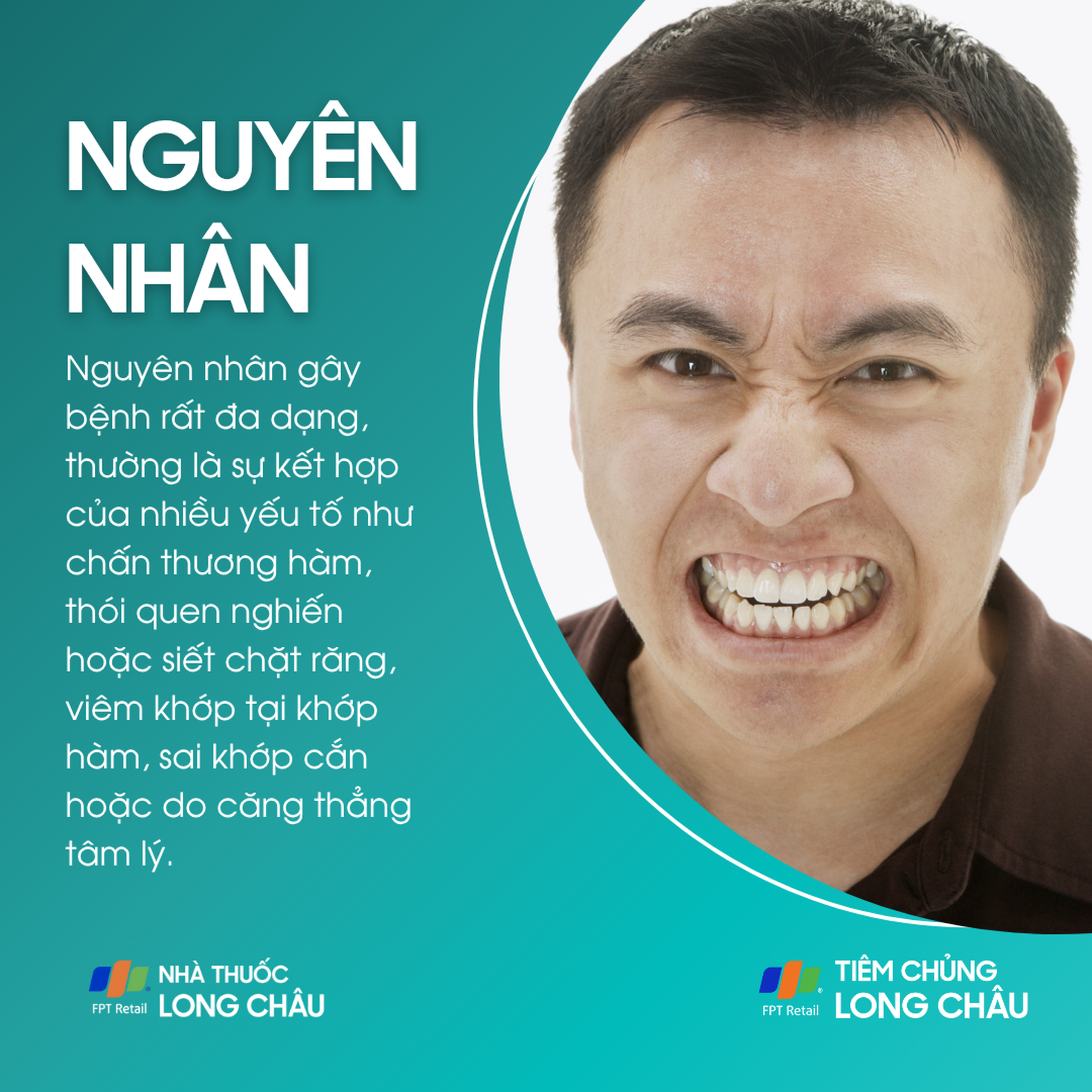 viem_khop_thai_duong_ham_3_db4d4dff45