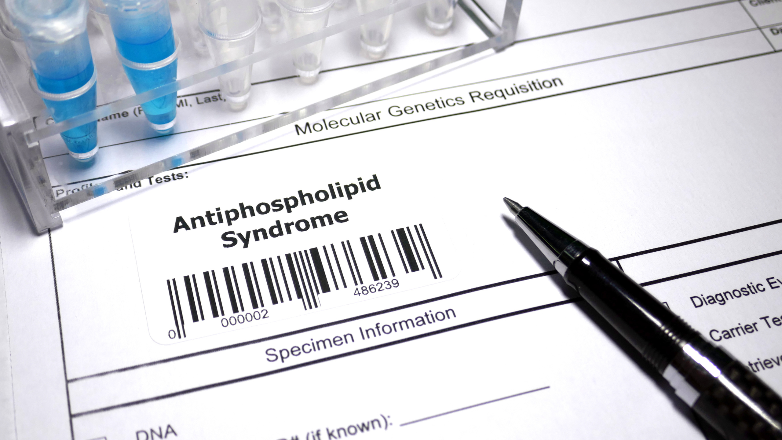 Xét nghiệm Antiphospholipid và những điều bạn cần biết