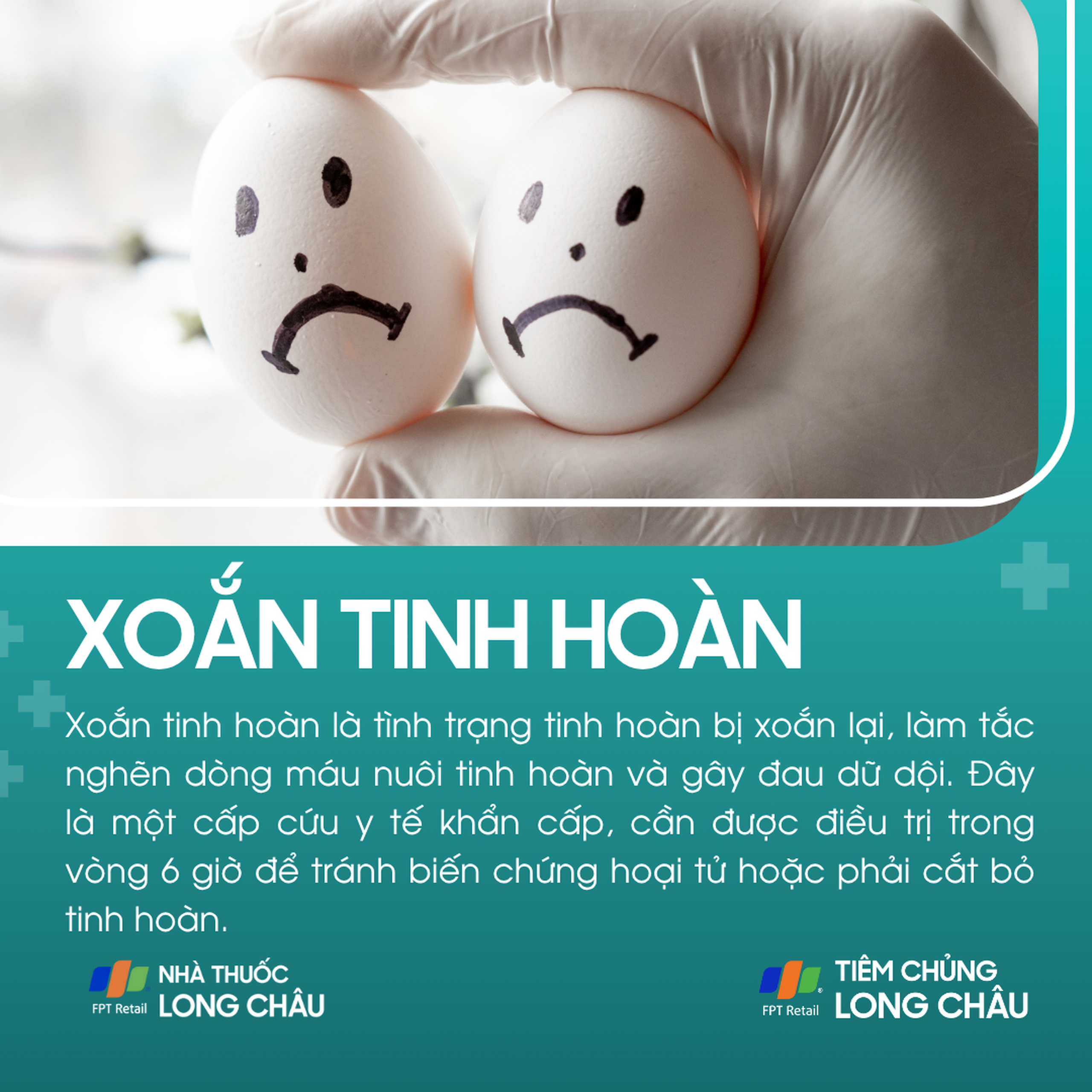 xoan_tinh_hoan_1_2546161a60