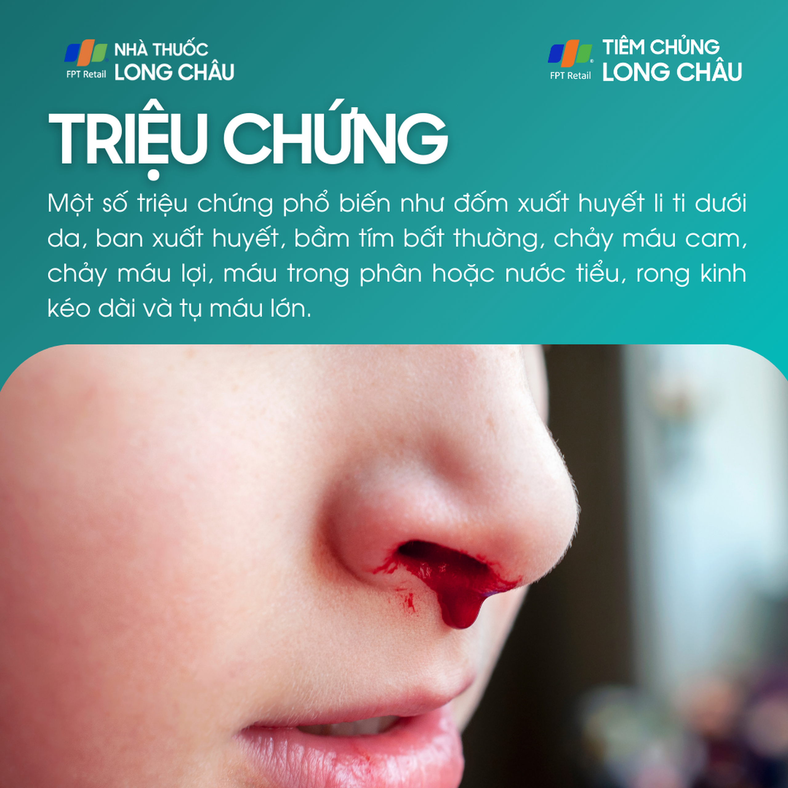 xuat_huyet_giam_tieu_cau_2_5c9f3a5ac9