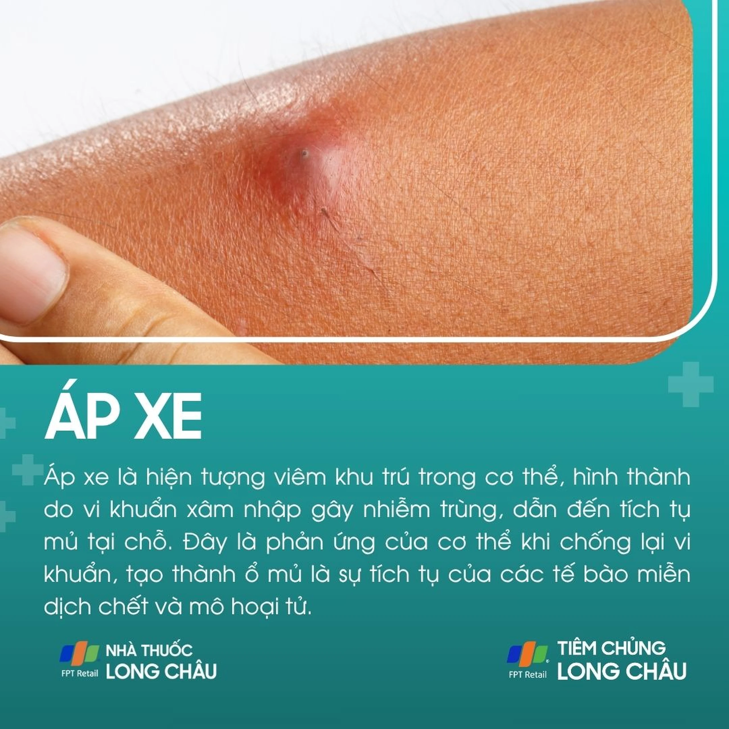 ap_xe_1_38eca05e34