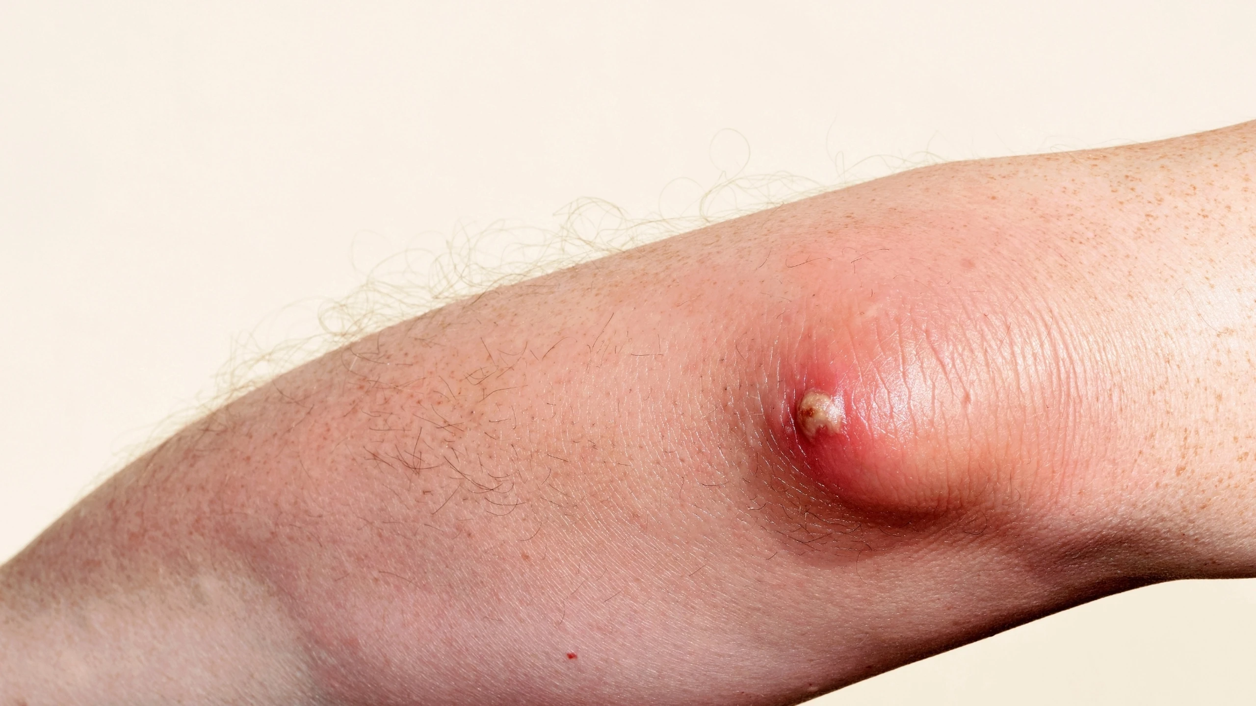 benh_a_z_ap_xe_da_0_28a021d3c0