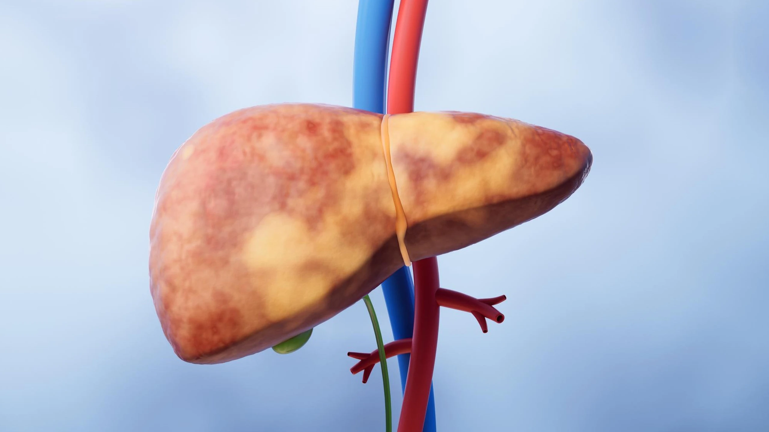 benh_a_z_benh_nang_gan_9b0d8a7f71