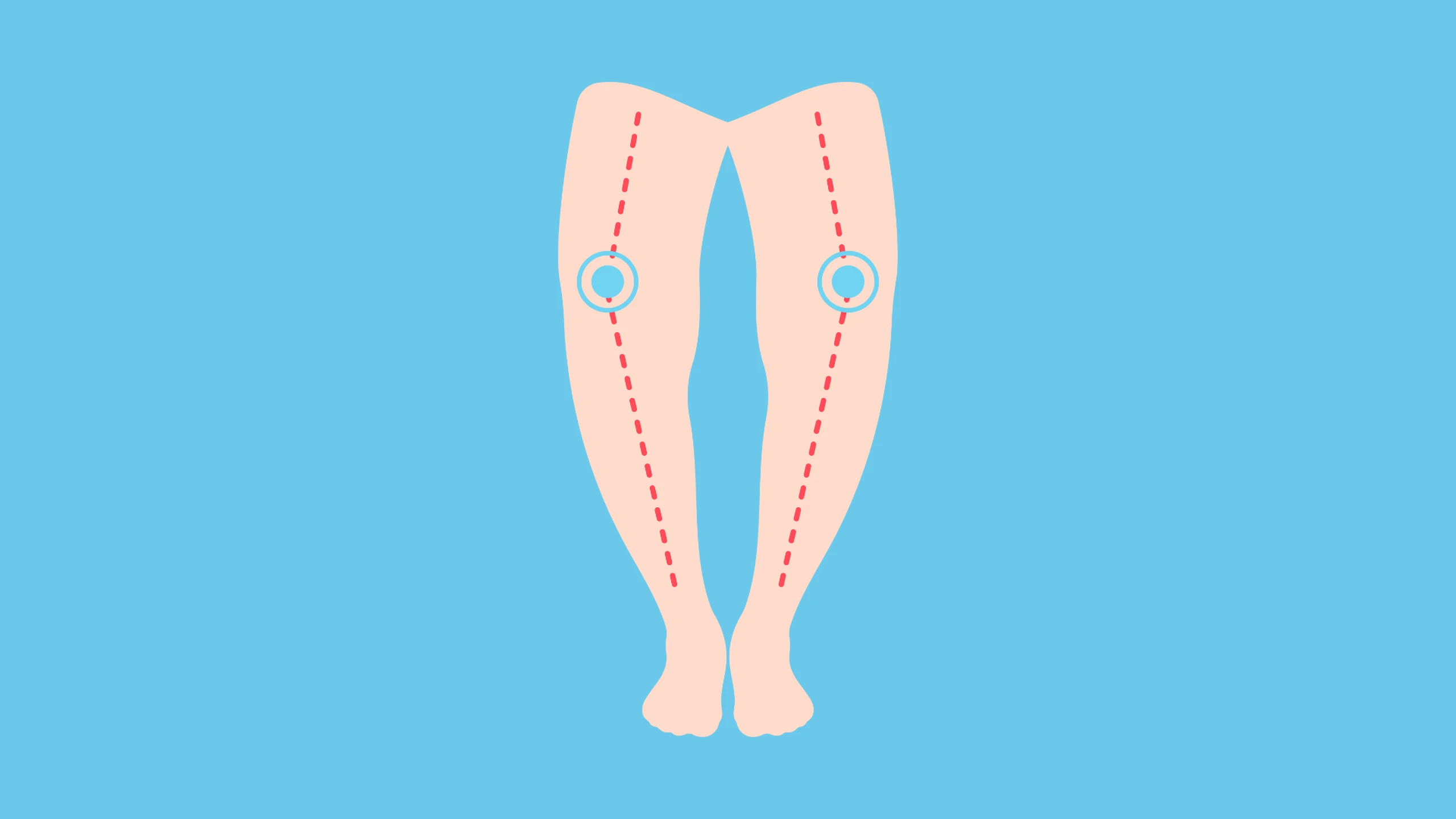 benh_a_z_chan_vong_kieng_bf41d2afb8