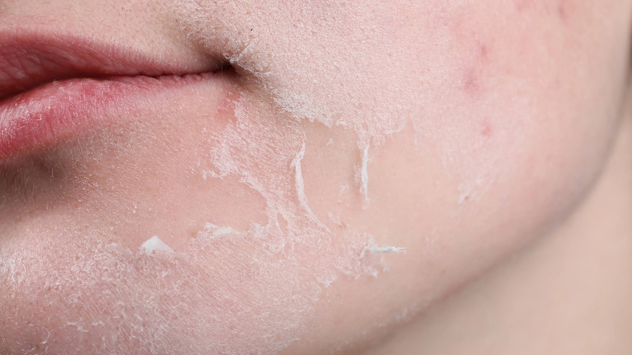 benh_a_z_da_kho_0_f1bc182db1