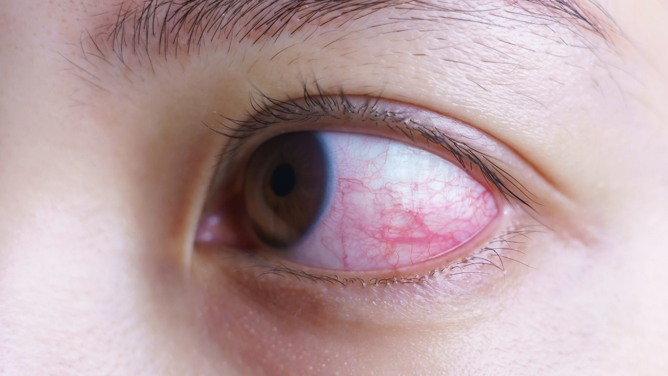 benh_a_z_dau_mat_do_4b83efe67c