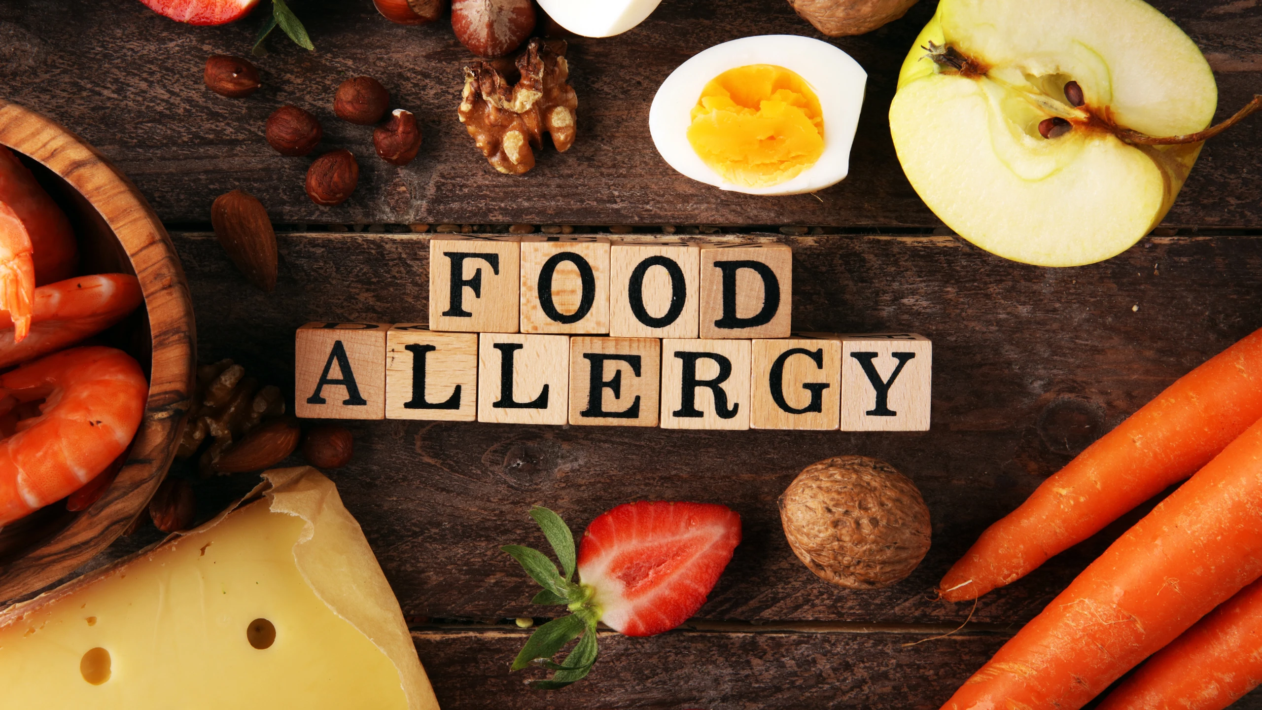 benh_a_z_di_ung_thuc_an_a202370353