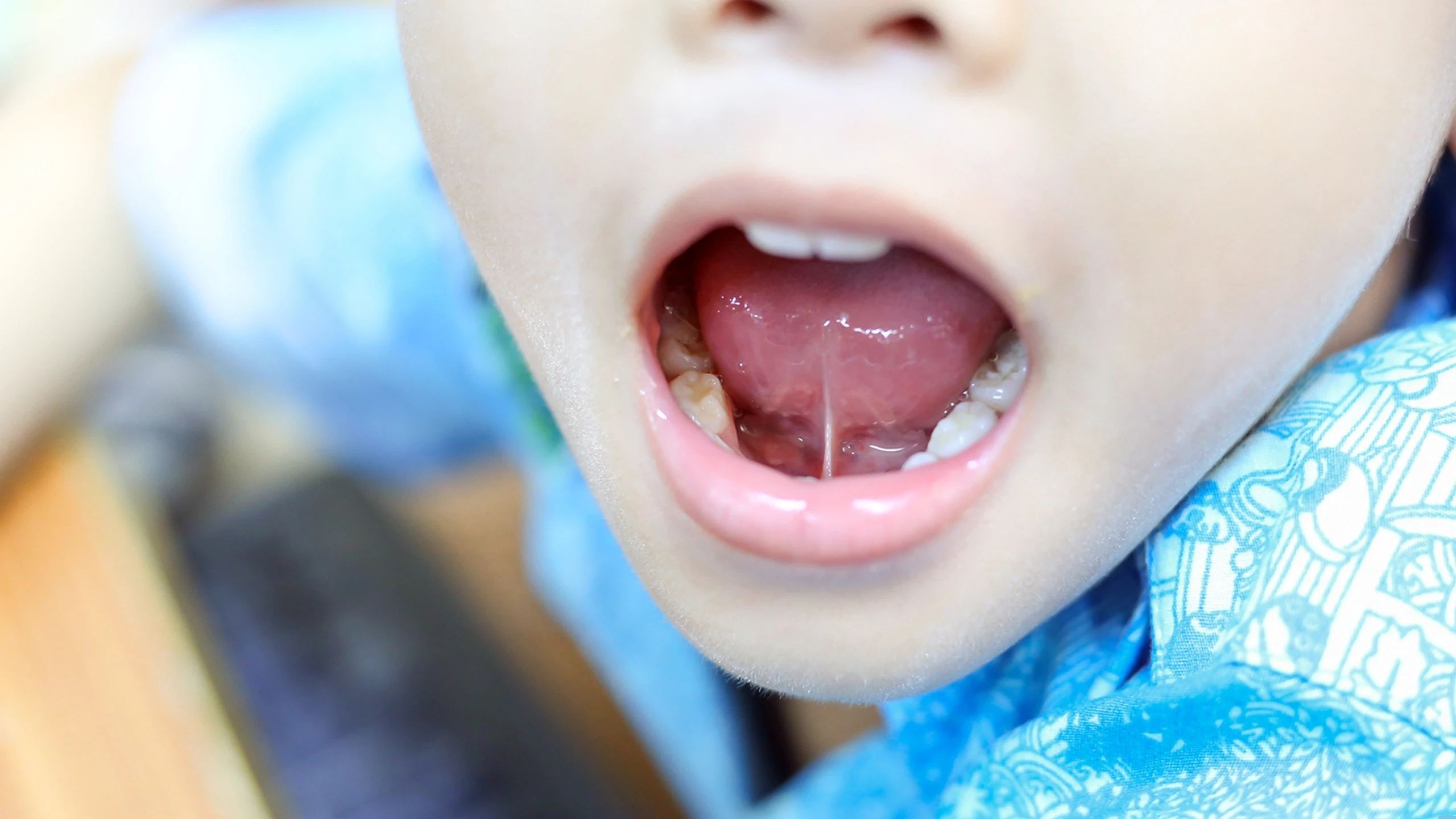 benh_a_z_dinh_thang_luoi_559878a6be